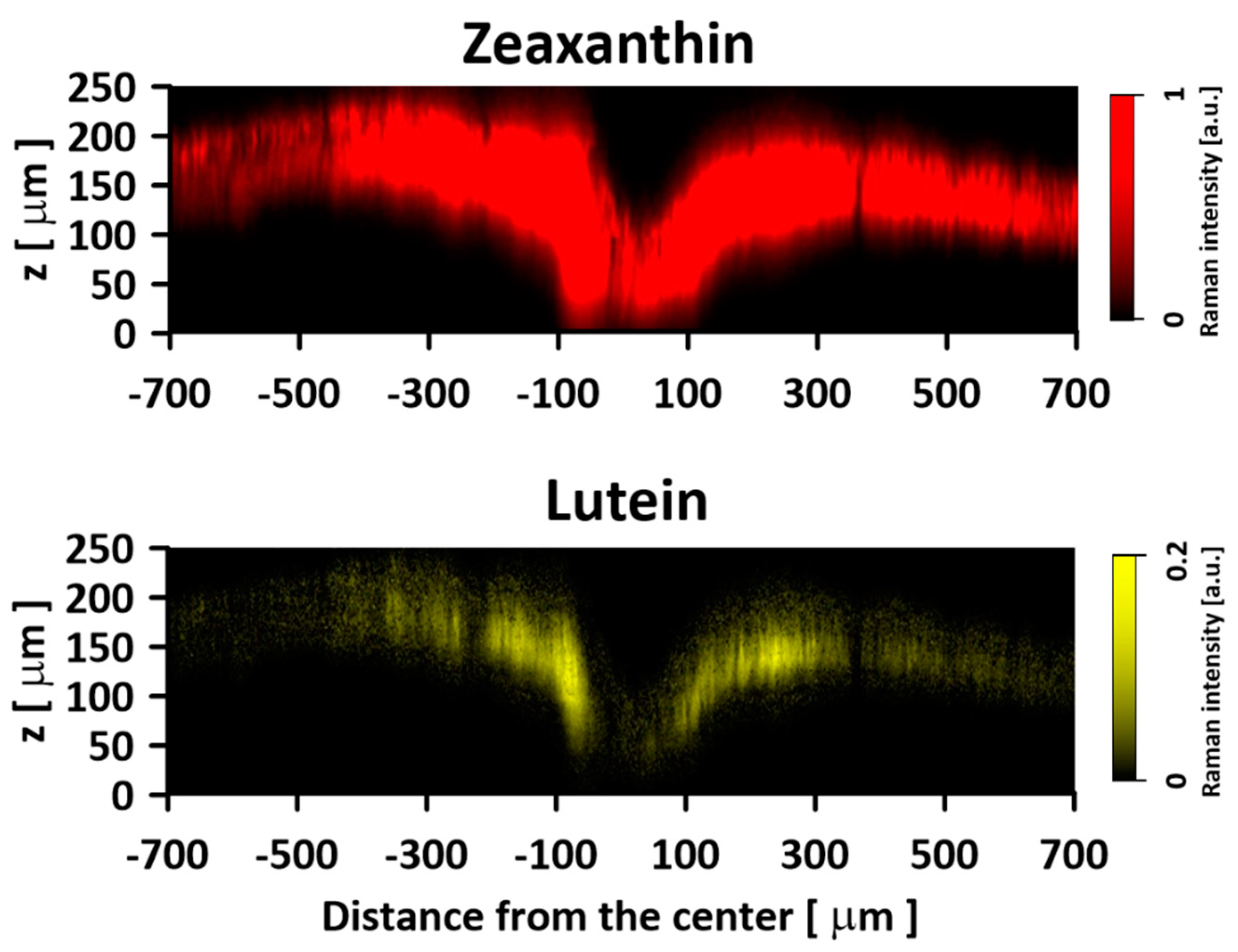 IJMS Free FullText Physiological Significance of the Heterogeneous