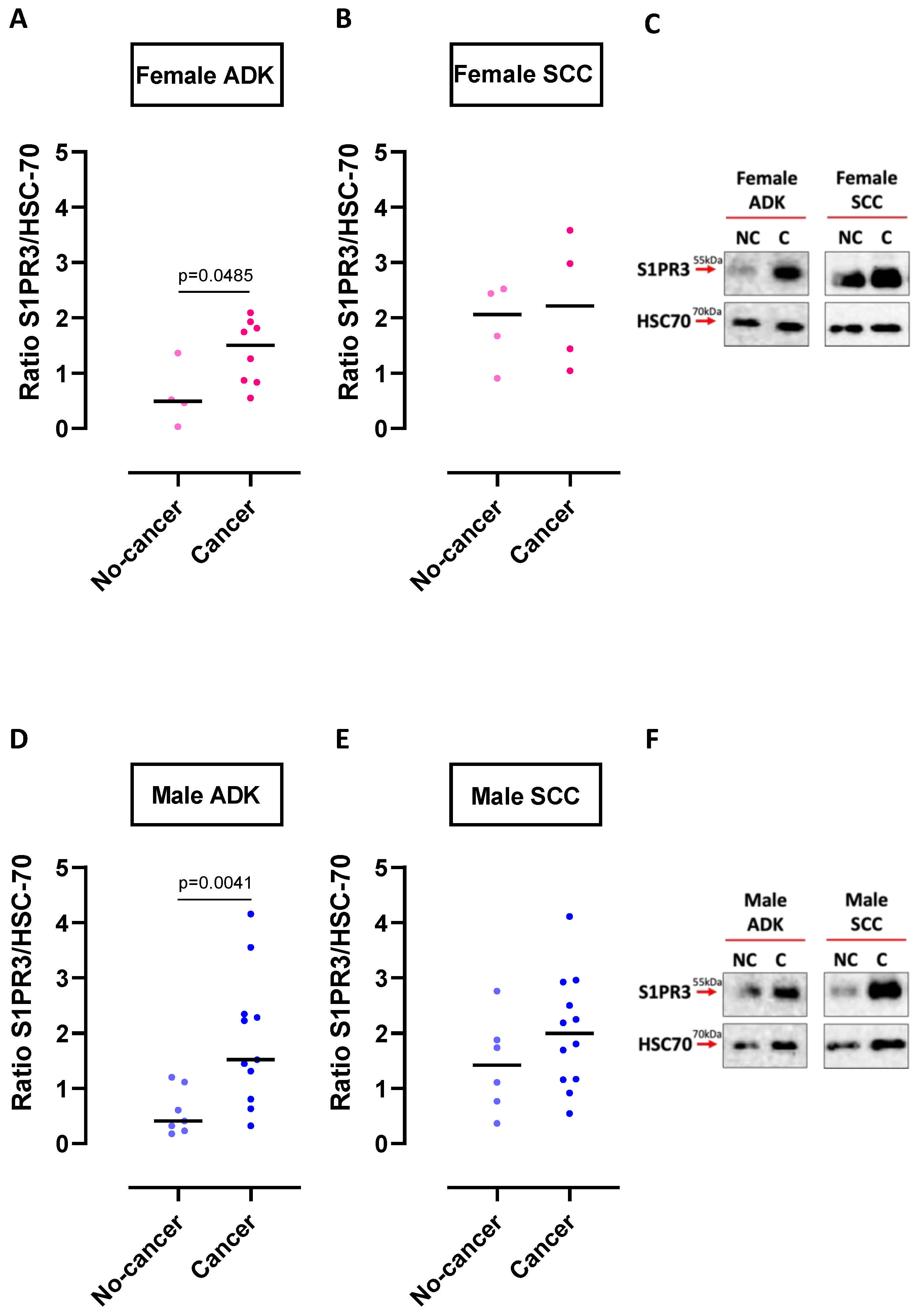 Ijms Free Full Text Sex Differences In Sphingosine 1 Phosphate Levels Are Dependent On