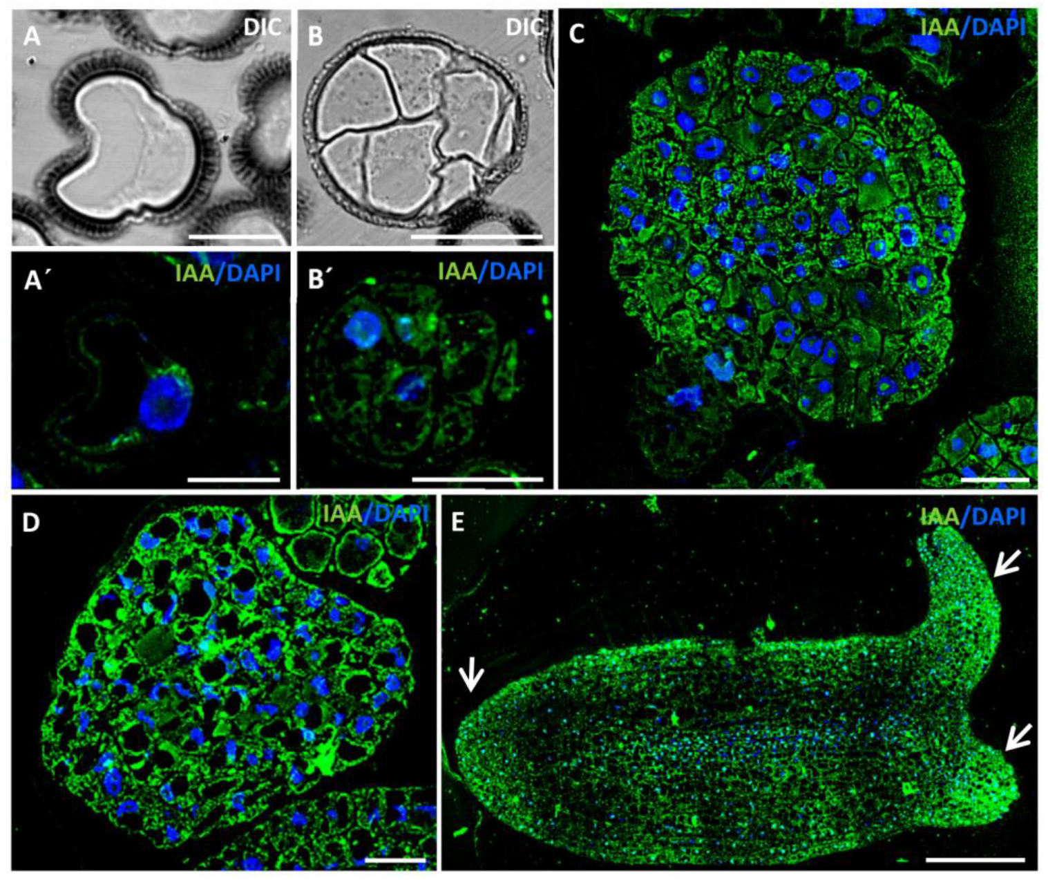 Ijms 24 11177 g004 Ijms 24 11177 g004
