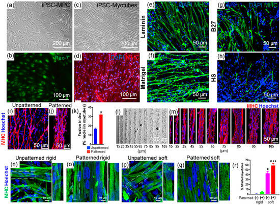 Skeletal muscle differentiation of human iPSCs meets bioengineering  strategies: perspectives and challenges