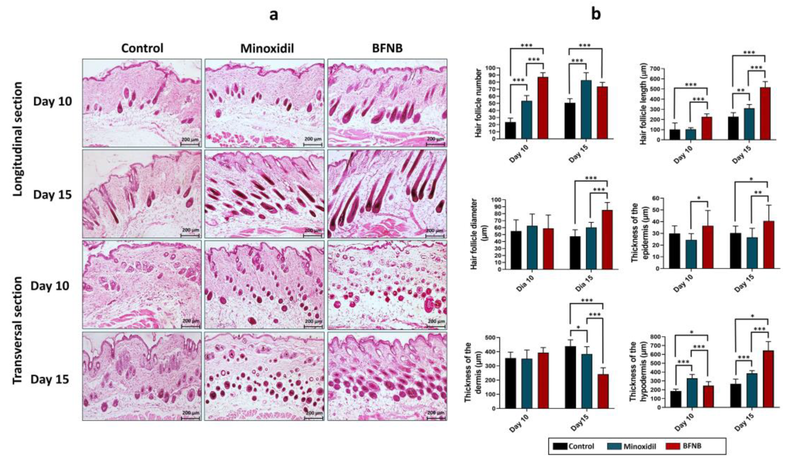 IJMS | Free Full-Text | BFNB Enhances Hair Growth in C57BL/6 Mice 