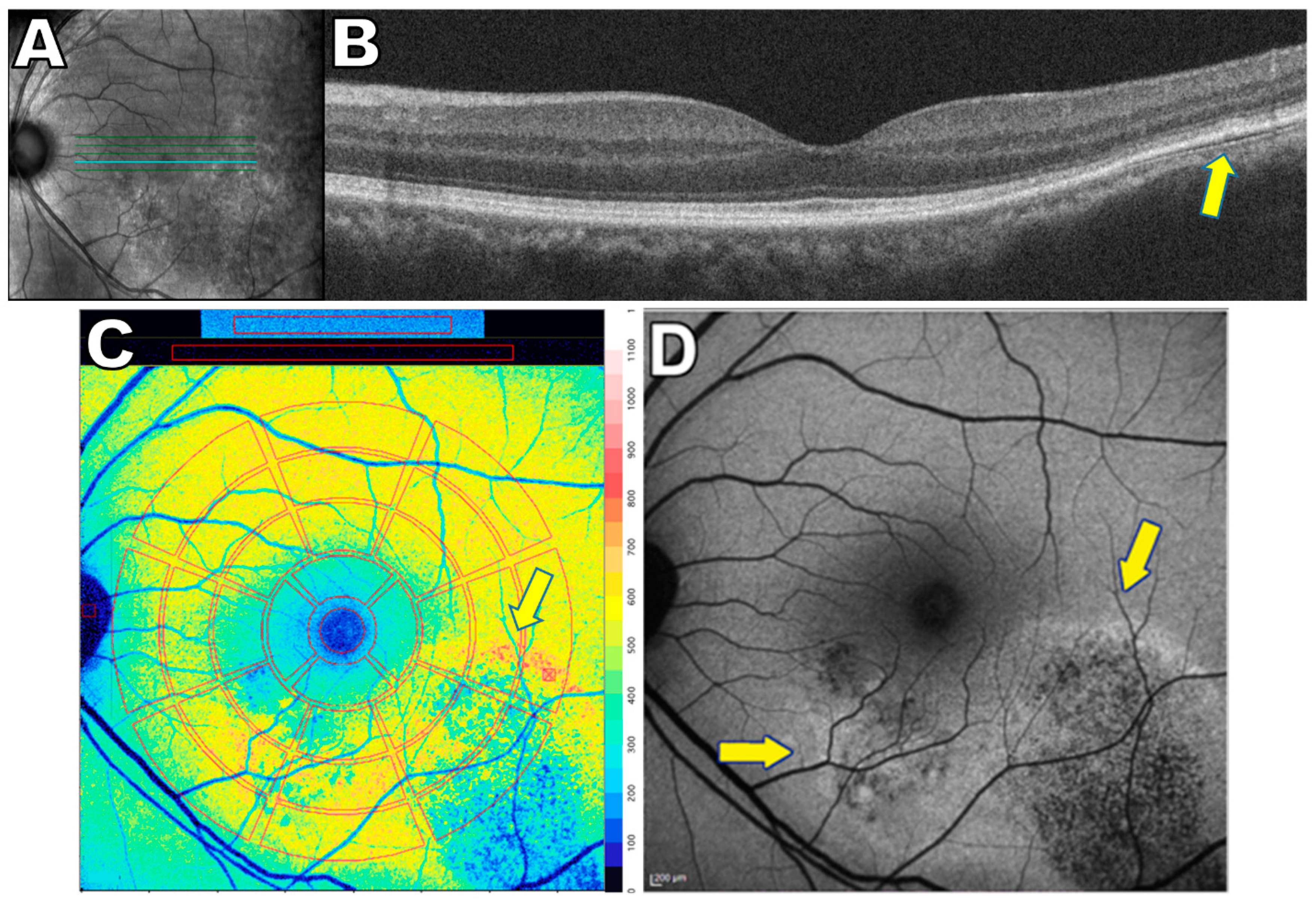 Ijms 24 12327 g006 Ijms 24 12327 g006