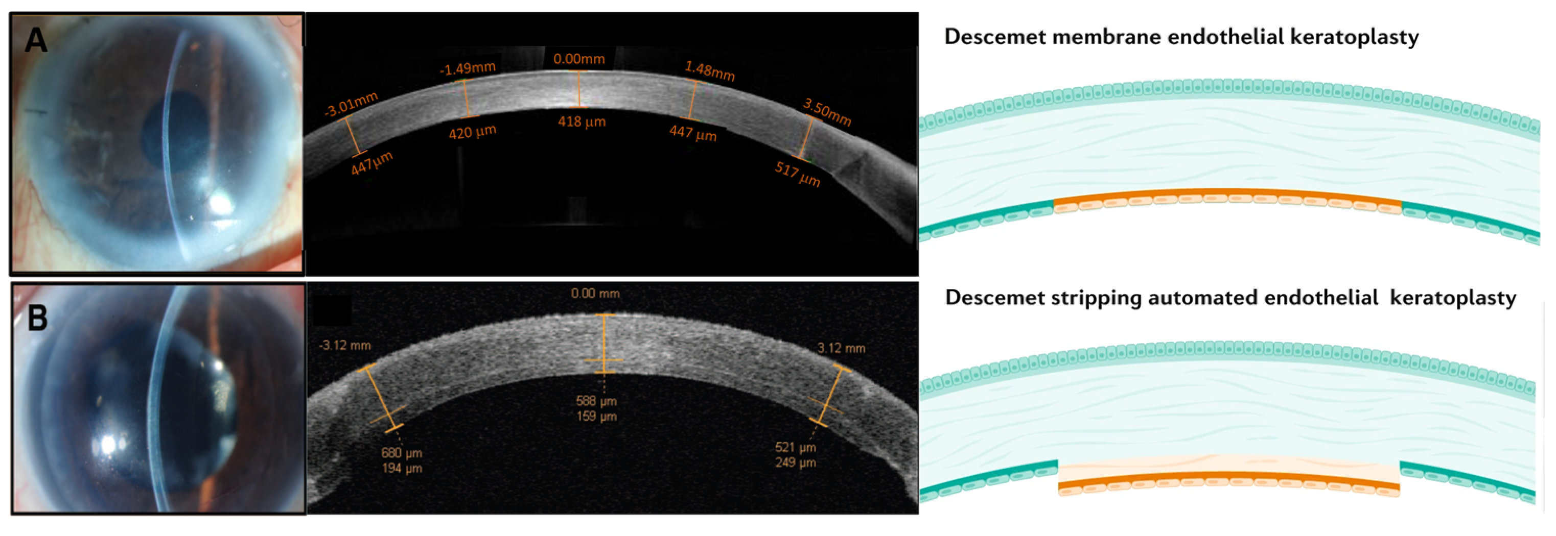 Ijms Free Full Text Corneal Endothelial Like Cells Derived From