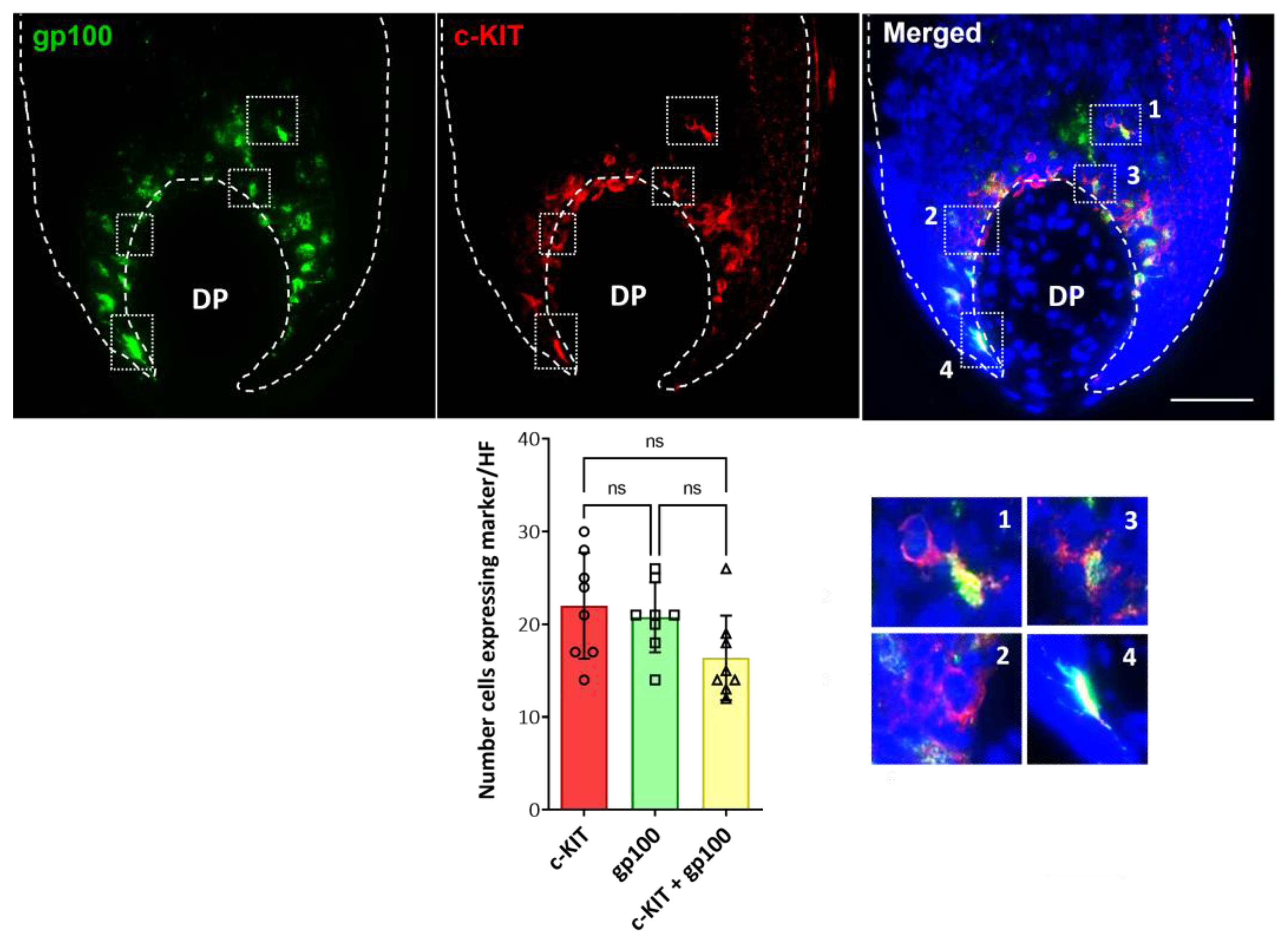 Ijms 24 12809 g004 Ijms 24 12809 g004