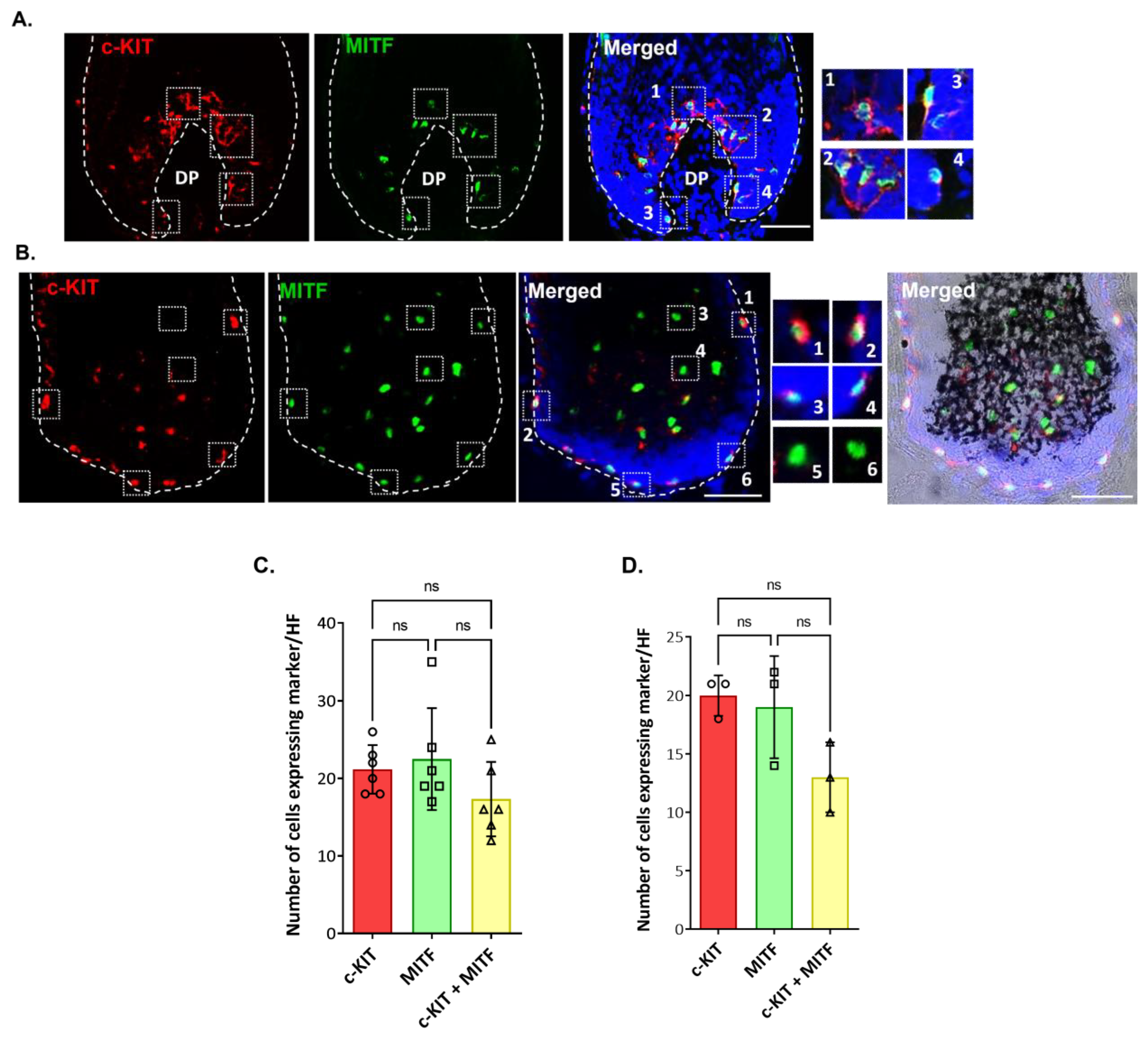 Ijms 24 12809 g005 Ijms 24 12809 g005