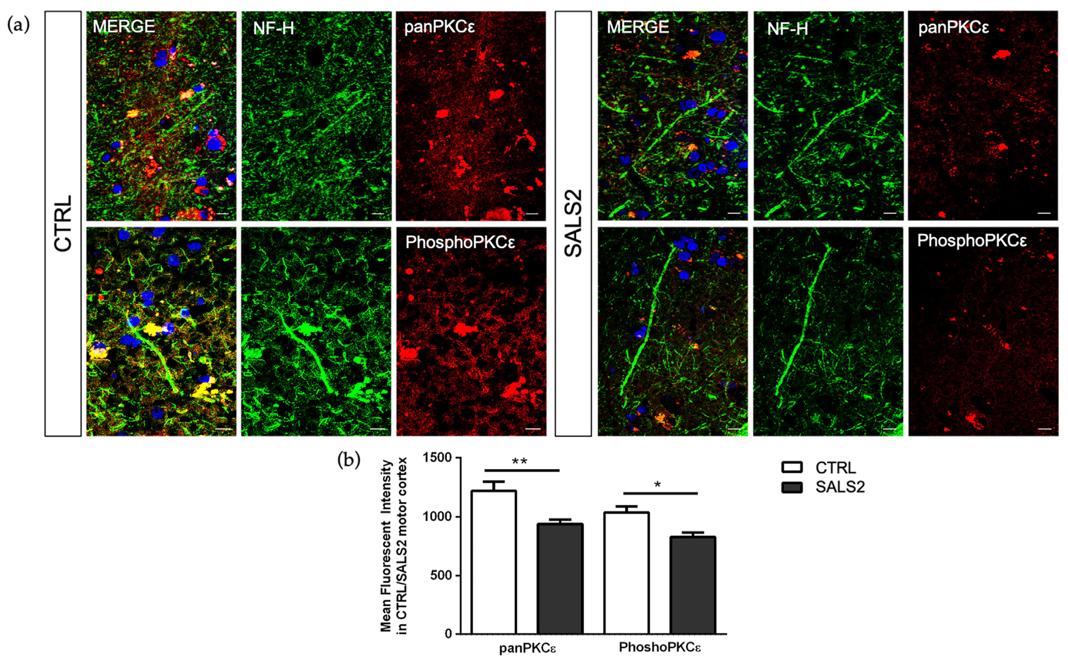 Ijms 24 12825 g004 Ijms 24 12825 g004