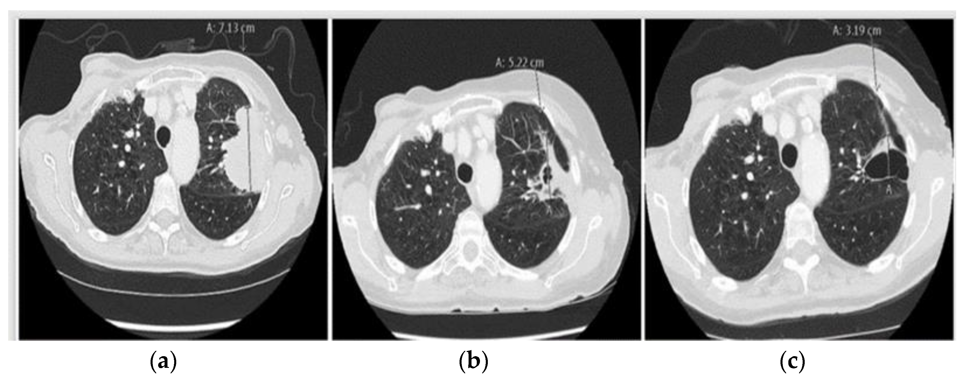 Ijms 24 13077 g005 Ijms 24 13077 g005