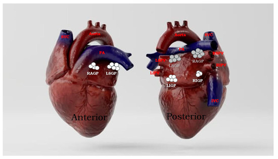 Tilt Test - AF-ABLATION