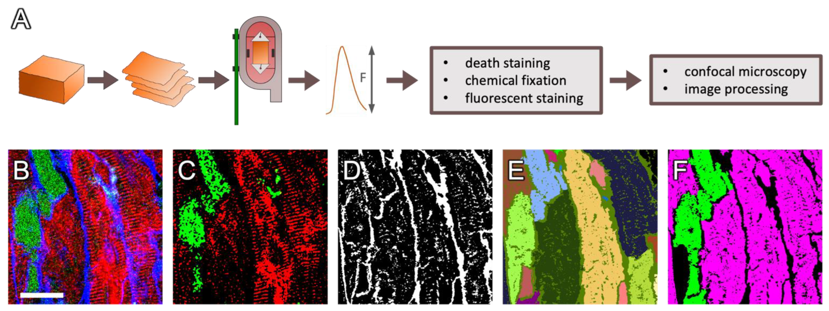 Cardiomyocyte orientation recovery at micrometer scale reveals