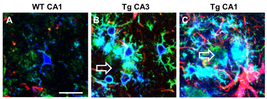 IJMS | Free Full-Text | Phenomic Microglia Diversity as a 