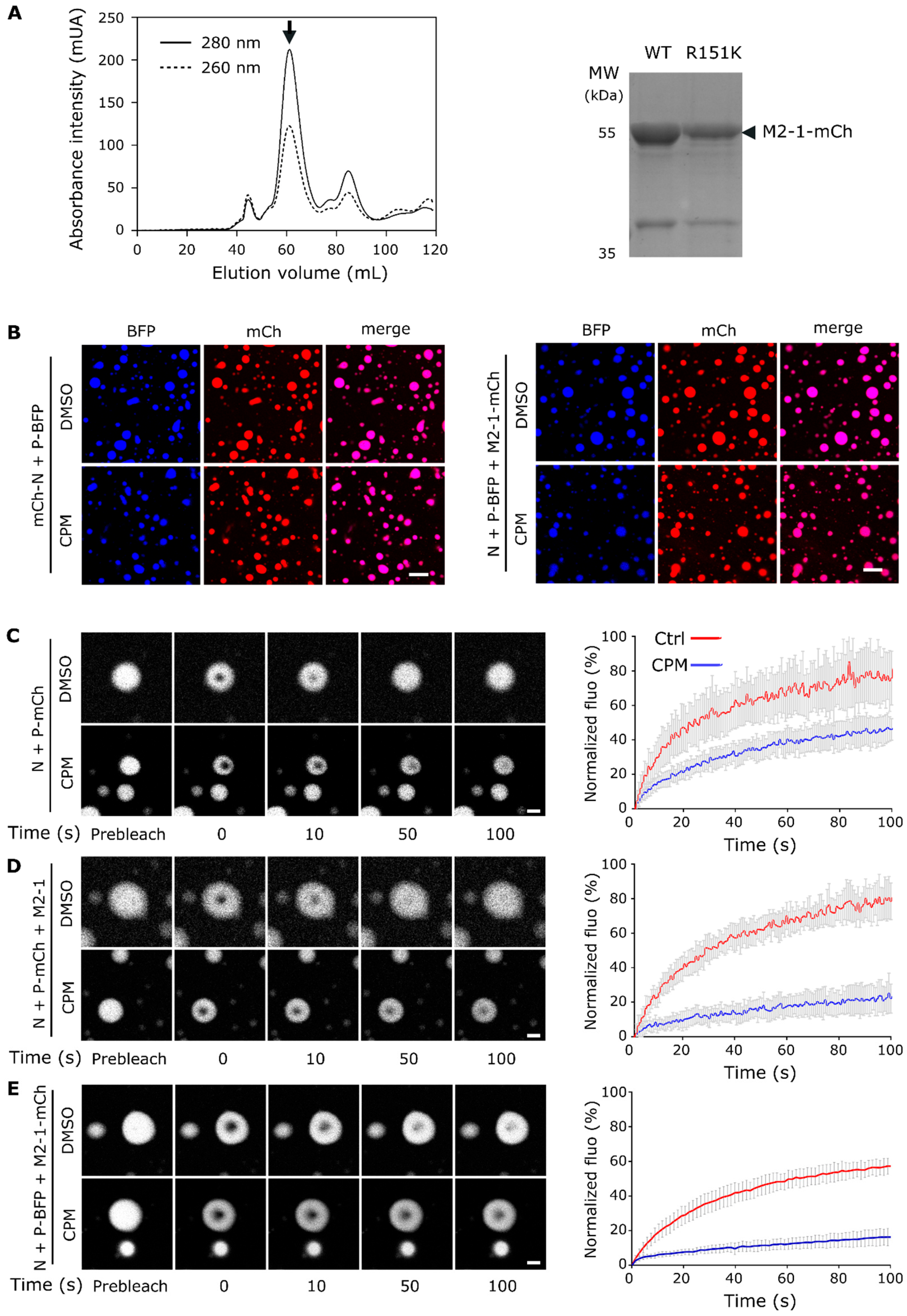 Functional organization of cytoplasmic inclusion bodies in cells infected  by respiratory syncytial virus