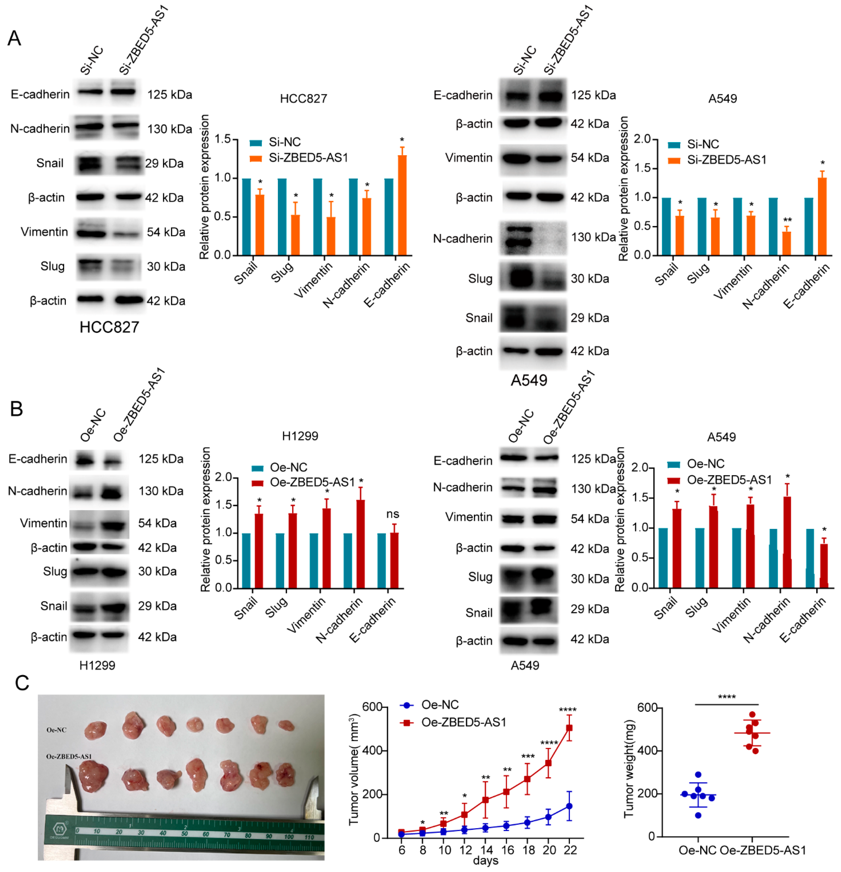 IJMS | Free Full-Text | Long Noncoding RNA ZBED5-AS1 Facilitates 