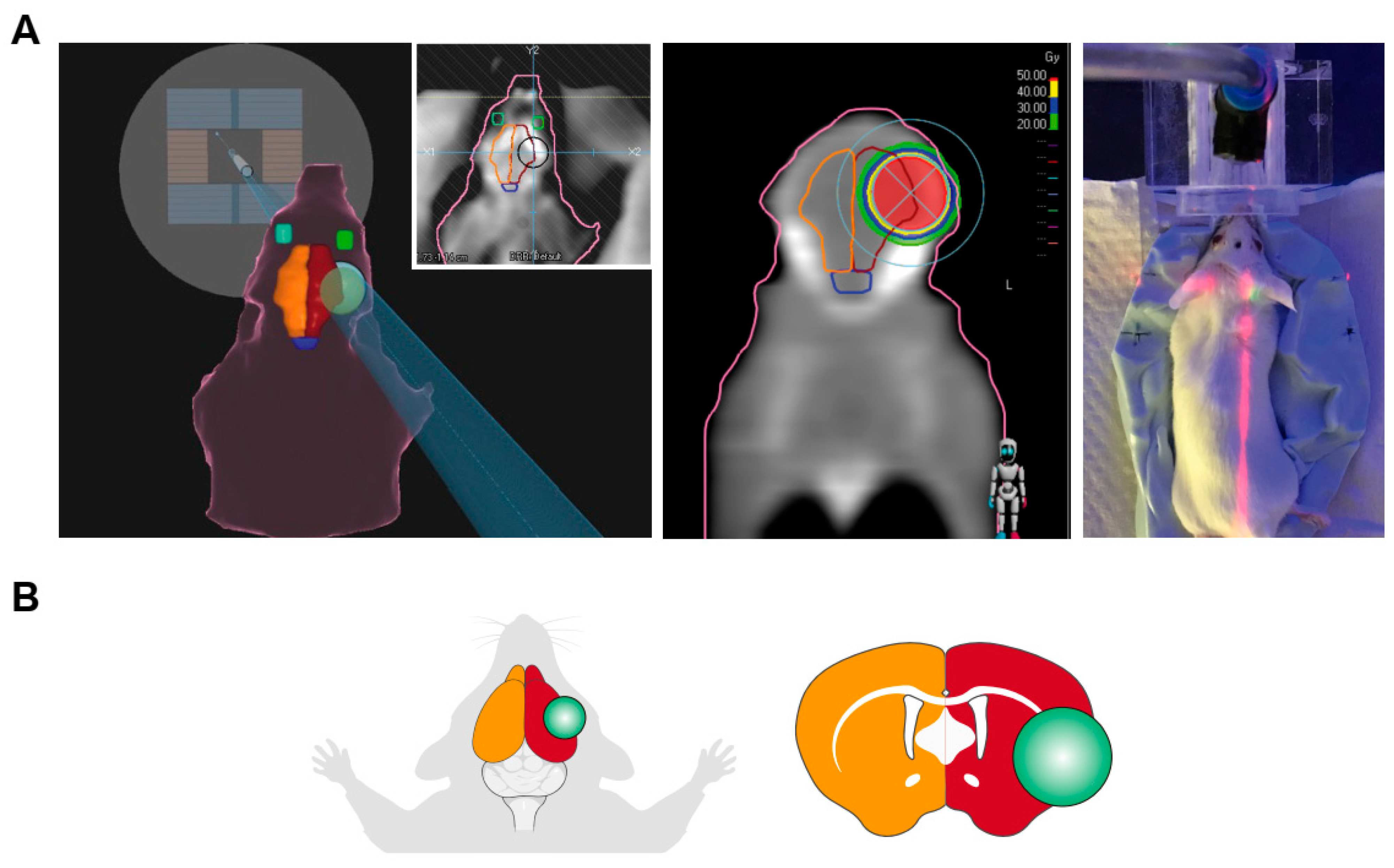 Radiation dose and incidence of new metastasis in the anterior