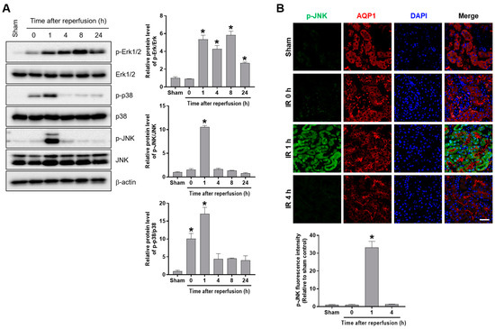 Ijms Free Full Text Early Growth Response 1 Contributes To Renal Ir