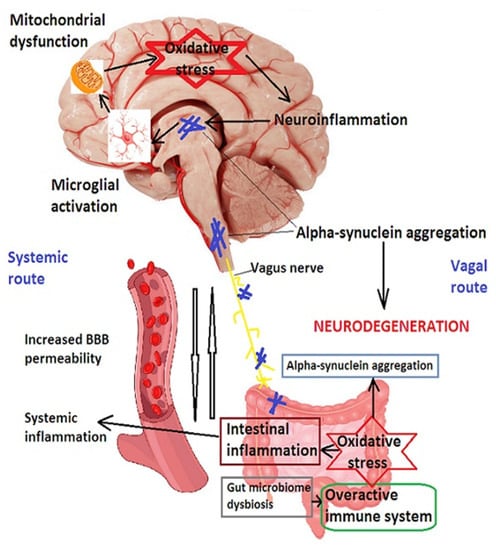 IJMS | Free Full-Text | The Involvement of Neuroinflammation in