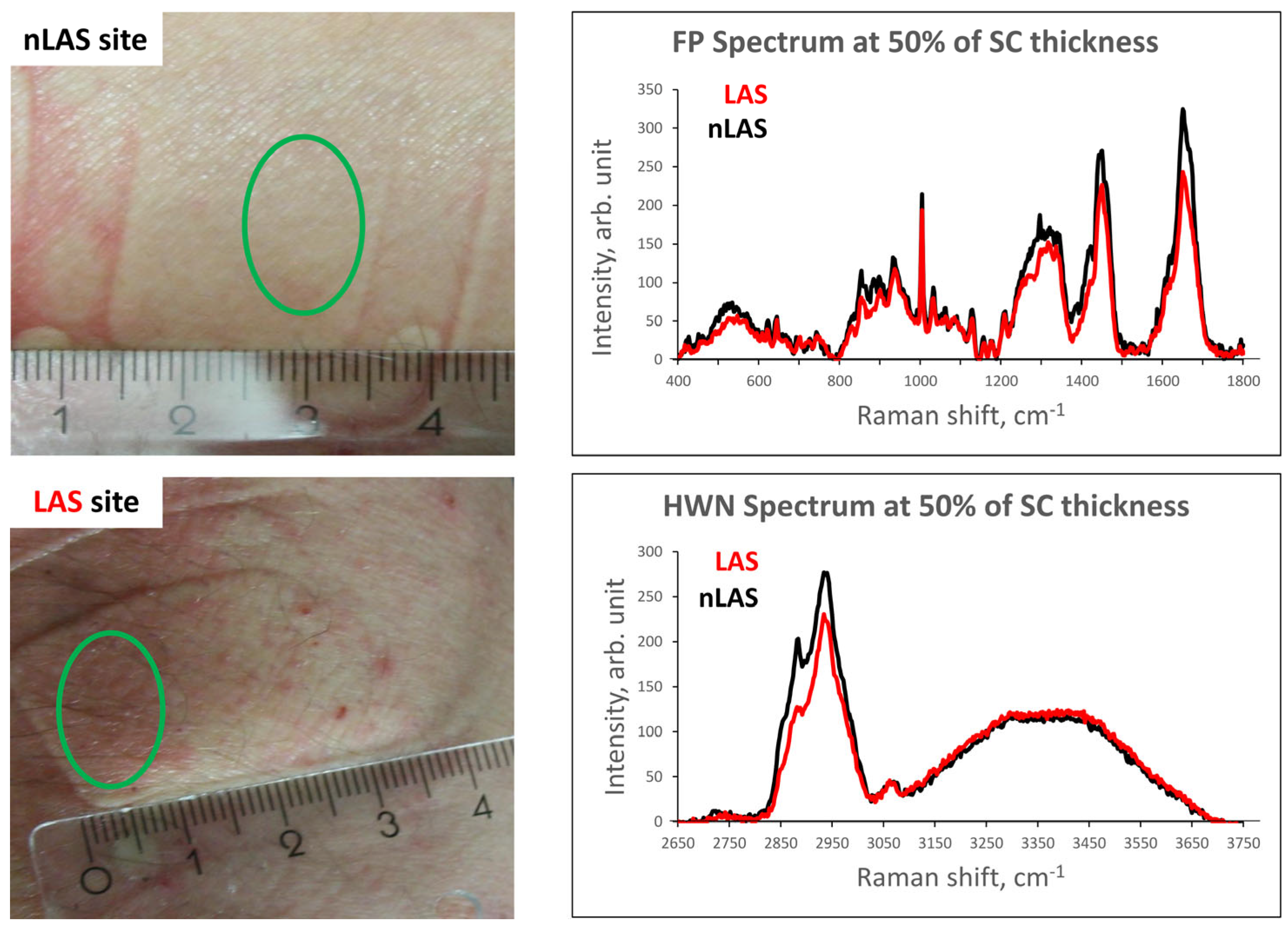 Ijms 24 14636 g004 Ijms 24 14636 g004