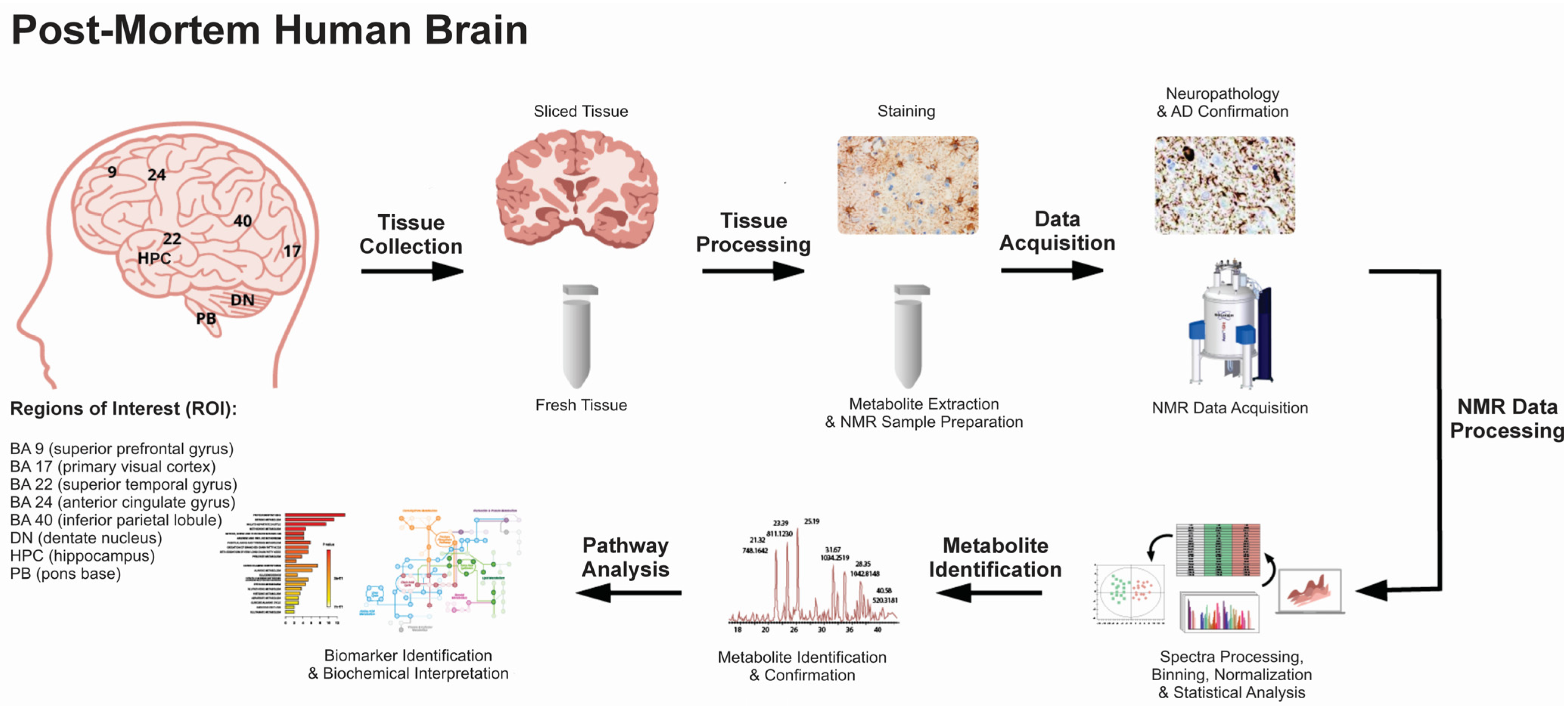 IJMS | Free Full-Text | Metabolomic Signatures of Alzheimer&rsquo