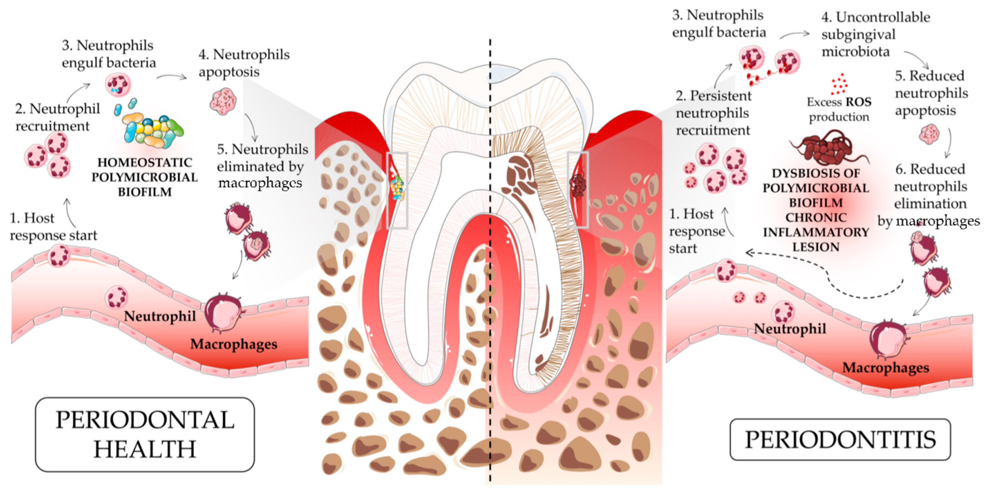 IJMS | Free Full-Text | Neutrophils’ Contribution to