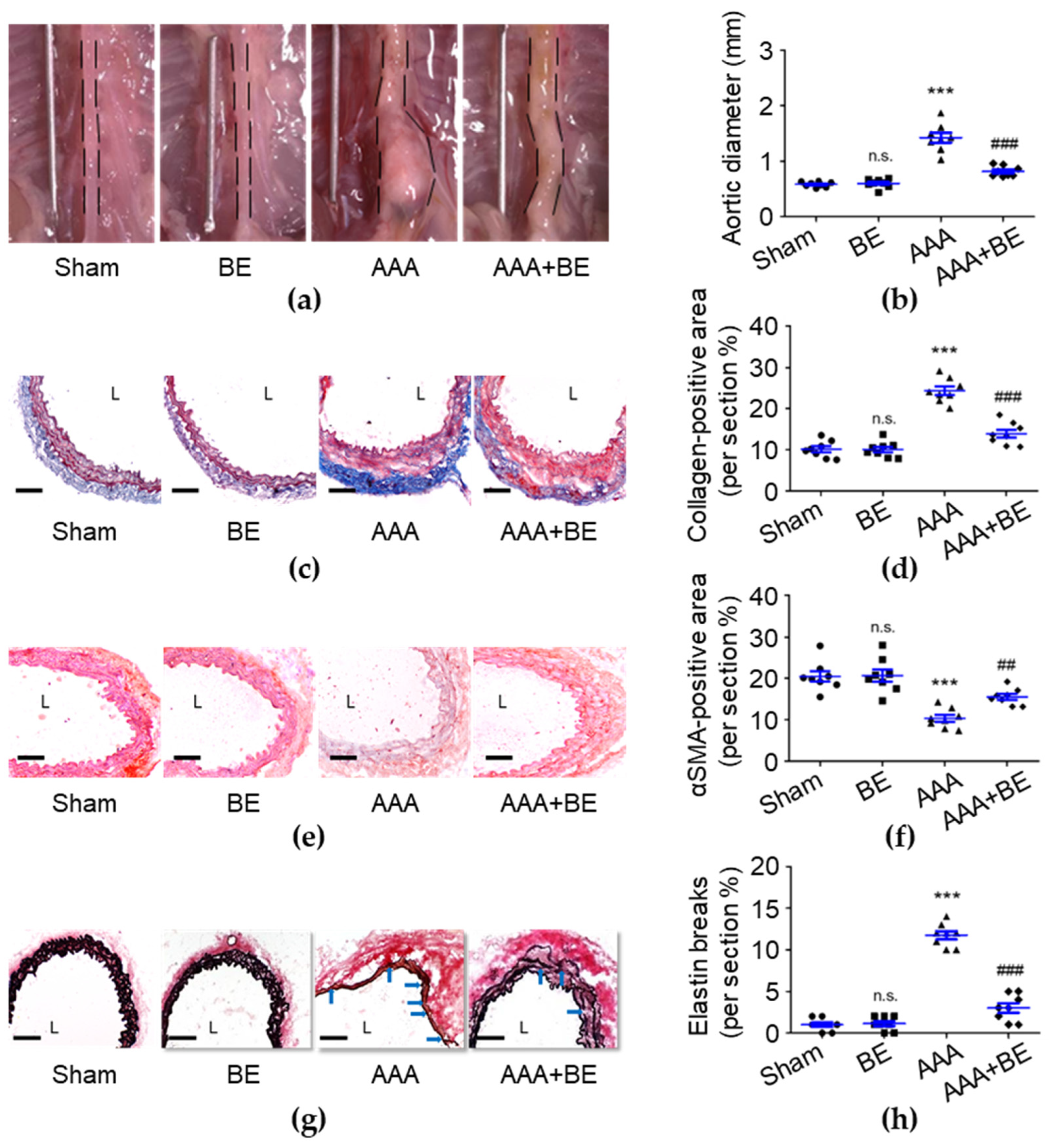 IJMS | Free Full-Text | Vasculoprotective Potential of Baicalein in  Angiotensin II-Infused Abdominal Aortic Aneurysms through Inhibiting  Inflammation and Oxidative Stress
