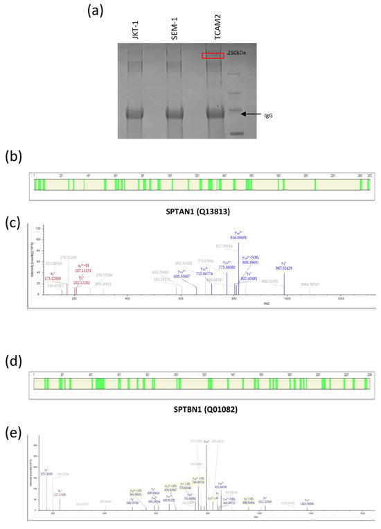 IJMS | Free Full-Text | SPTBN1 Mediates the Cytoplasmic Constraint 