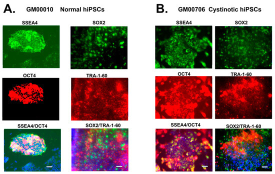 Lysosomal cystine export regulates mTORC1 signaling to guide kidney  epithelial cell fate specialization