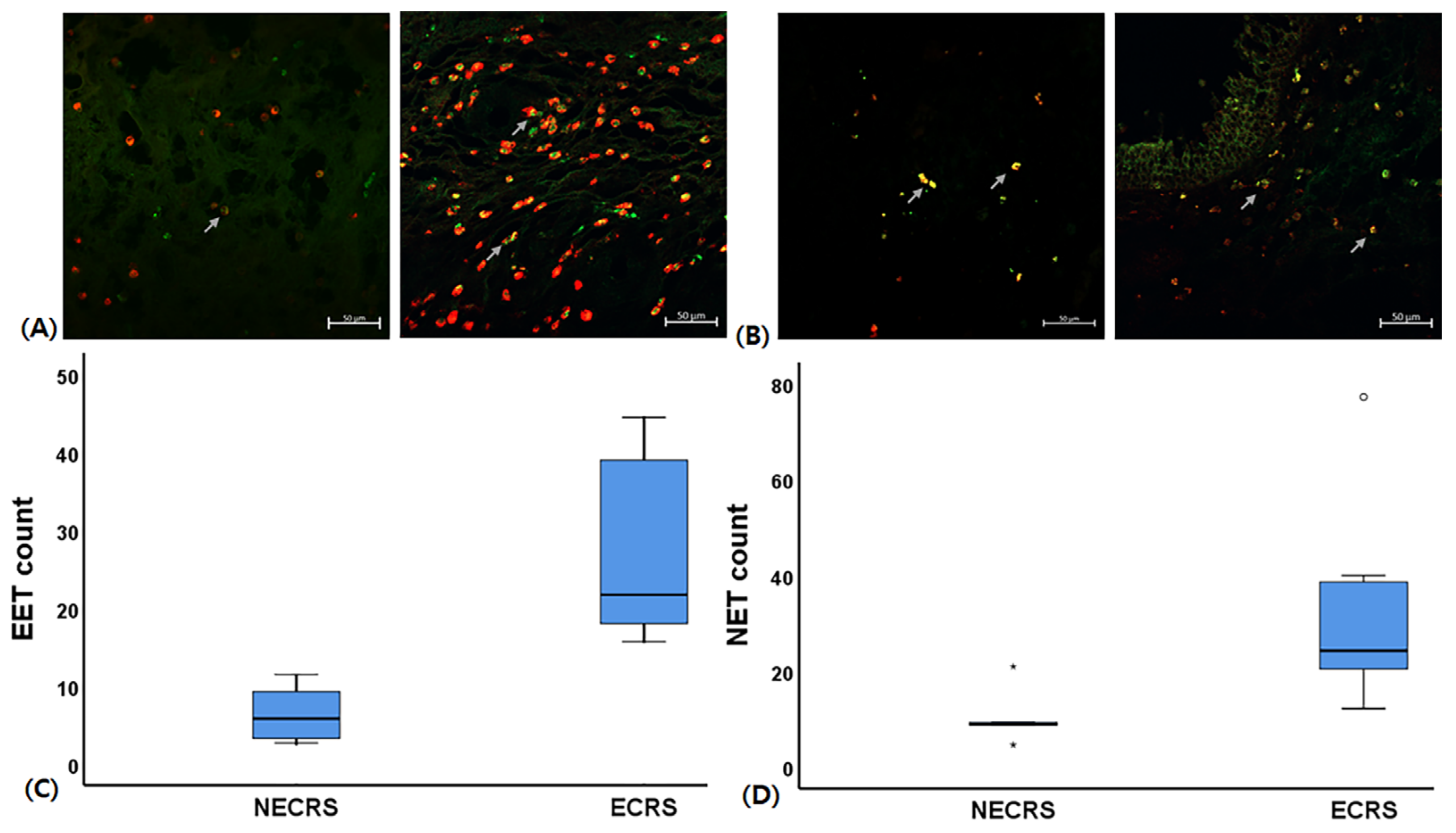 Ijms Free Full Text Aspergillus Enhances Eosinophil And Neutrophil Extracellular Dna Trap