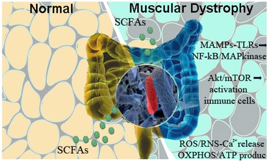 What is the Difference between Multiple Sclerosis And Muscular Dystrophy: Unveiling the Distinctive Characteristics