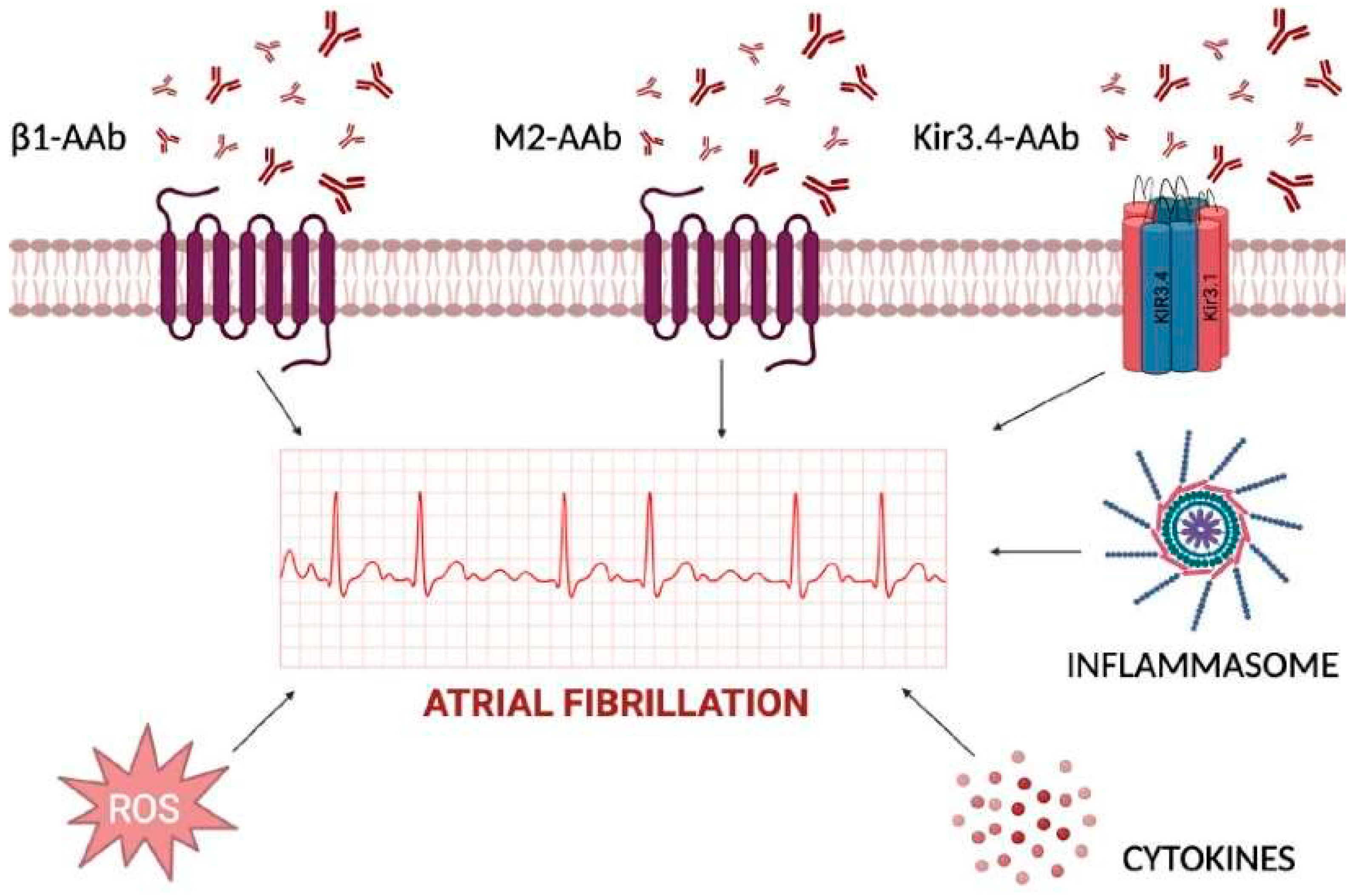 IJMS Free Full Text Pathophysiology of Atrial Fibrillation and