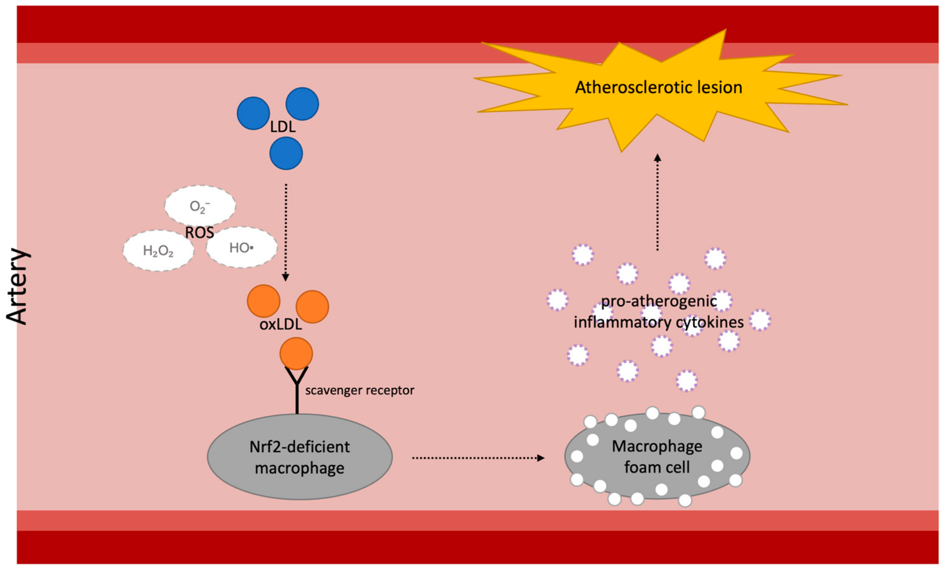 IJMS | Free Full-Text | Nrf2 Pathway and Oxidative Stress as a 