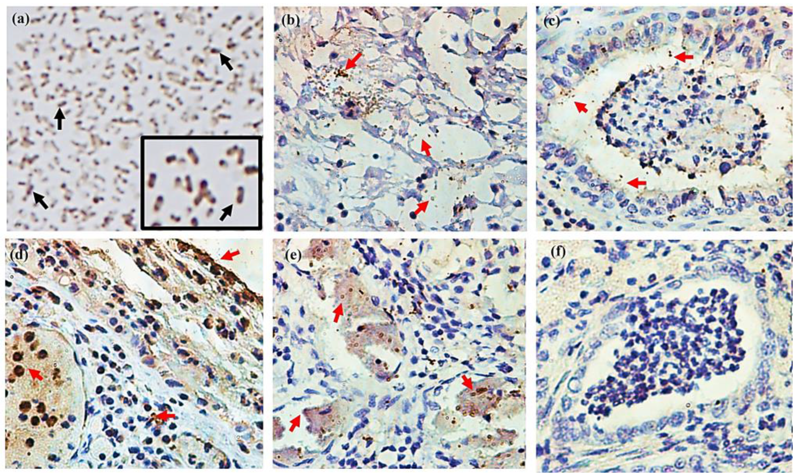 Ijms 25 01289 g009 Ijms 25 01289 g009