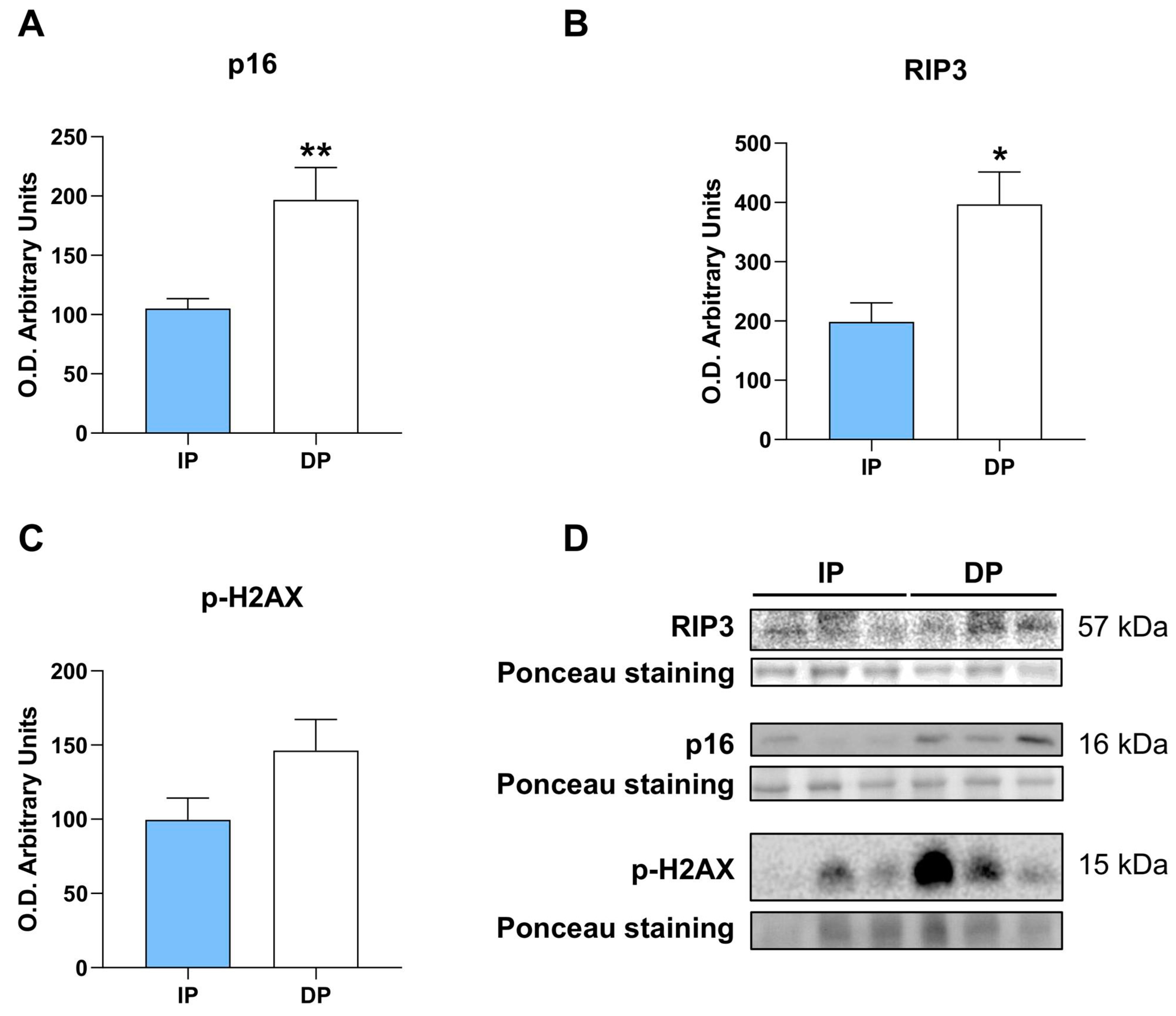 Ijms 25 01439 g005 Ijms 25 01439 g005