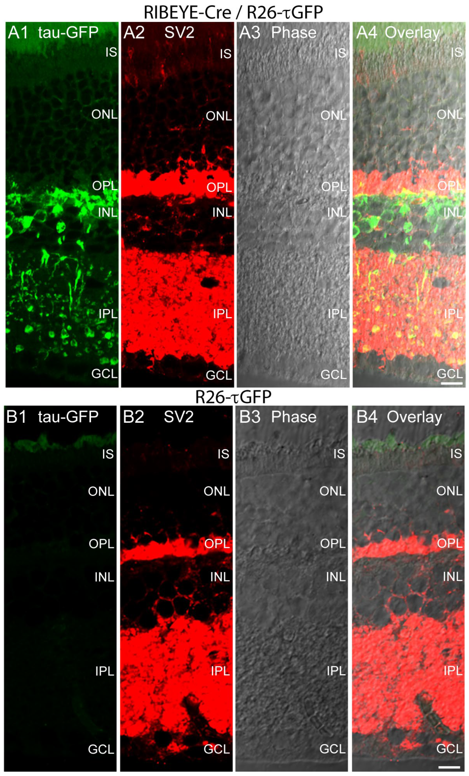 IJMS | Free Full-Text | A Novel Cre Recombinase Mouse Strain for