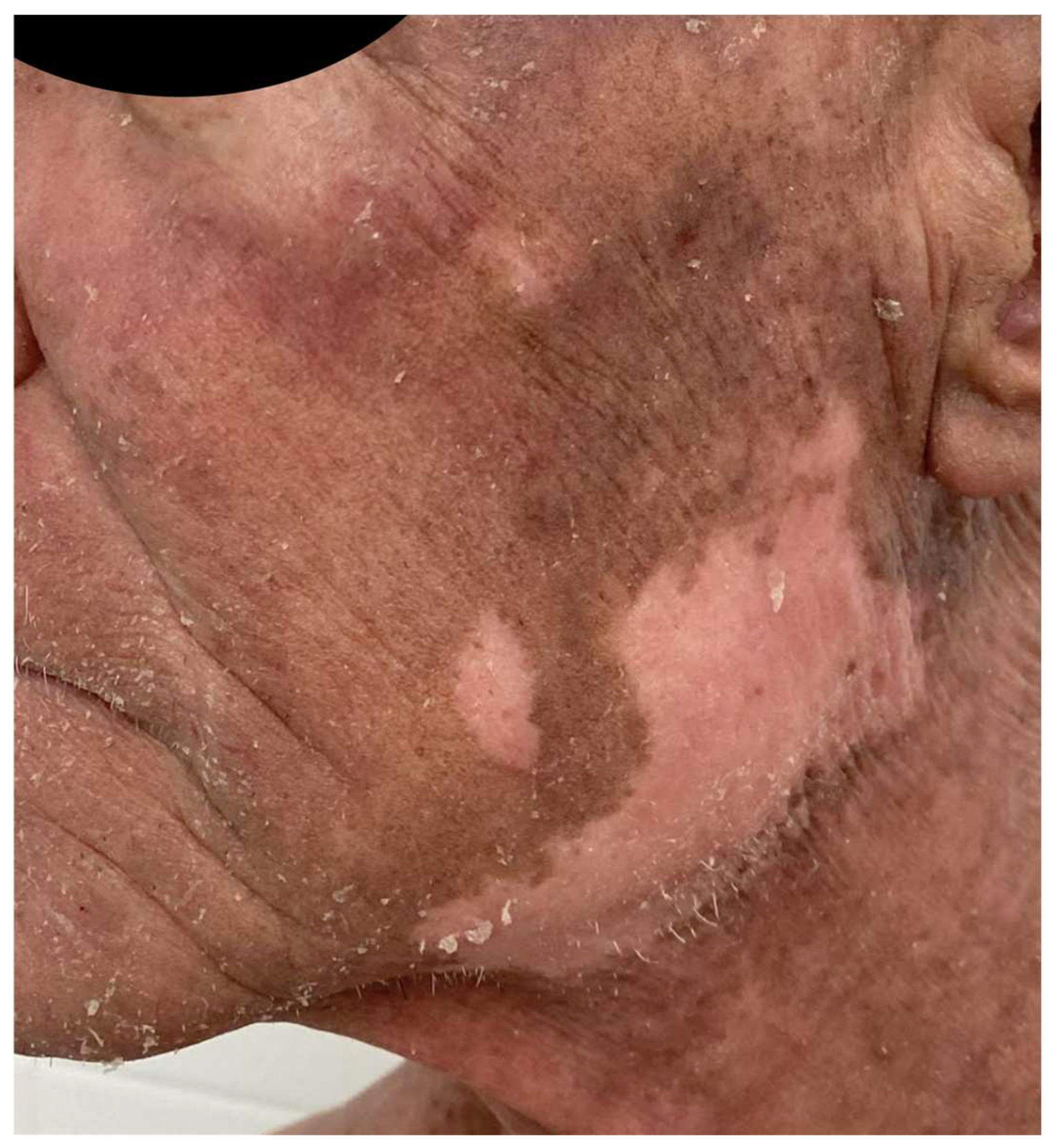 Ijms 25 02203 g005 Ijms 25 02203 g005