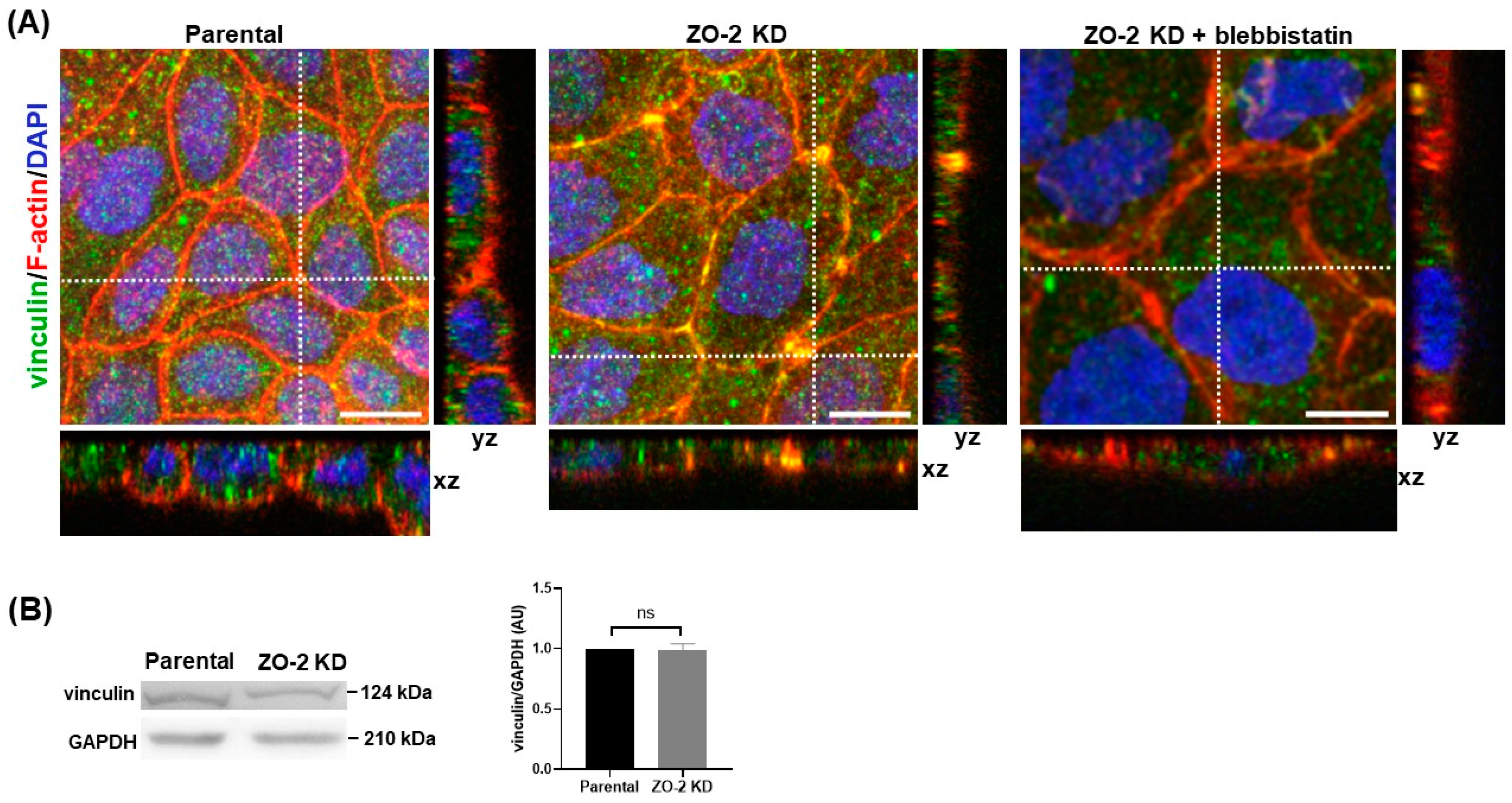 Ijms 25 02453 g009 Ijms 25 02453 g009