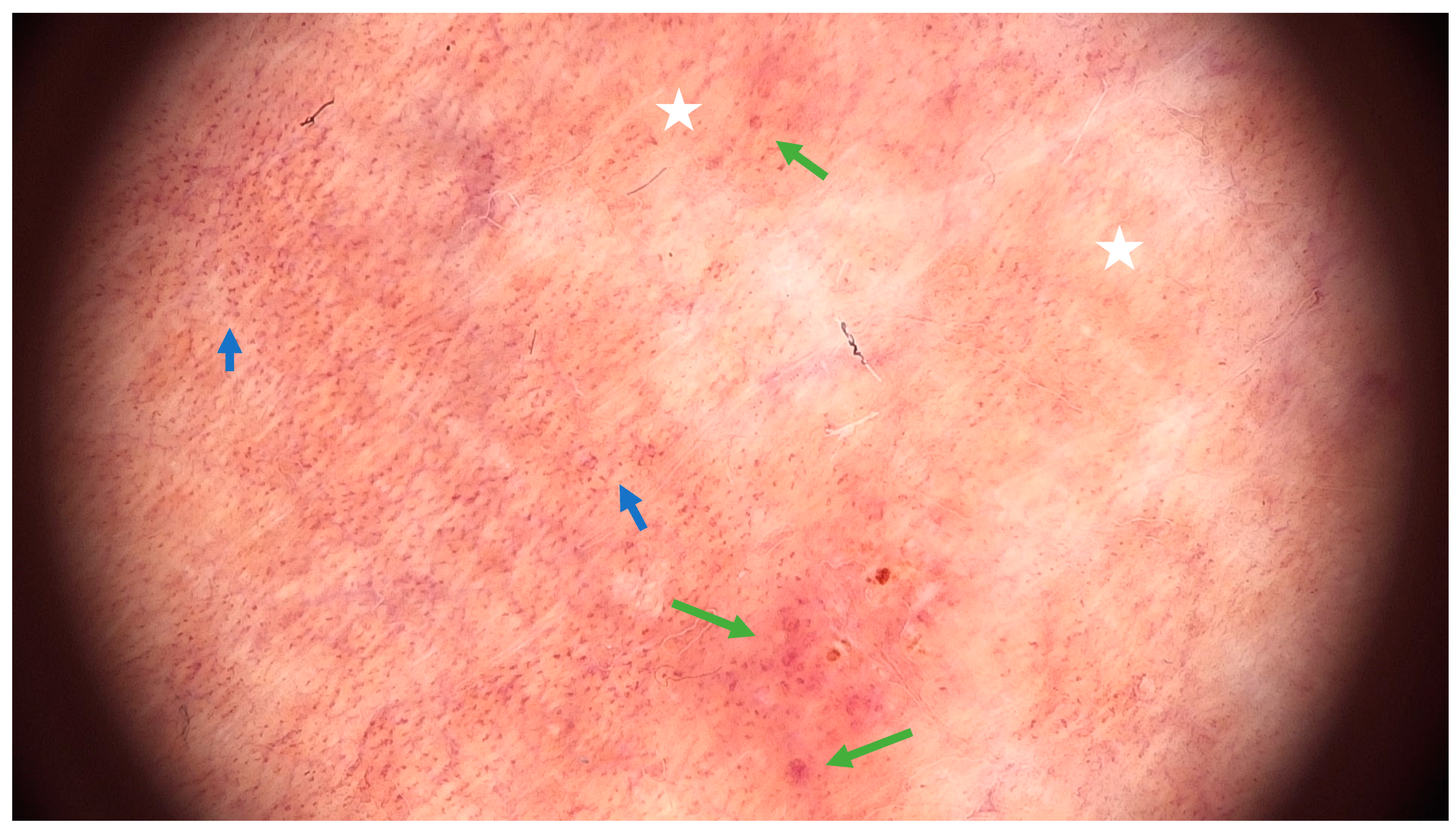 Ijms 25 02644 g003 Ijms 25 02644 g003