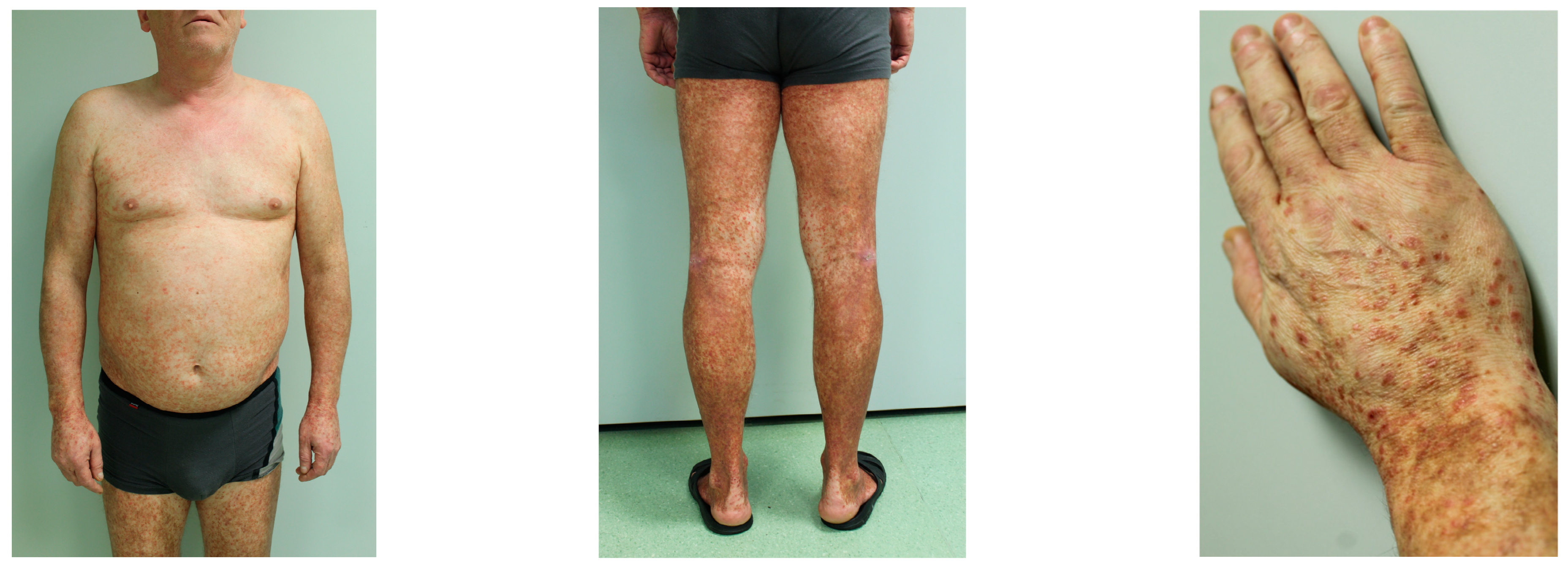 Ijms 25 02644 g004 Ijms 25 02644 g004