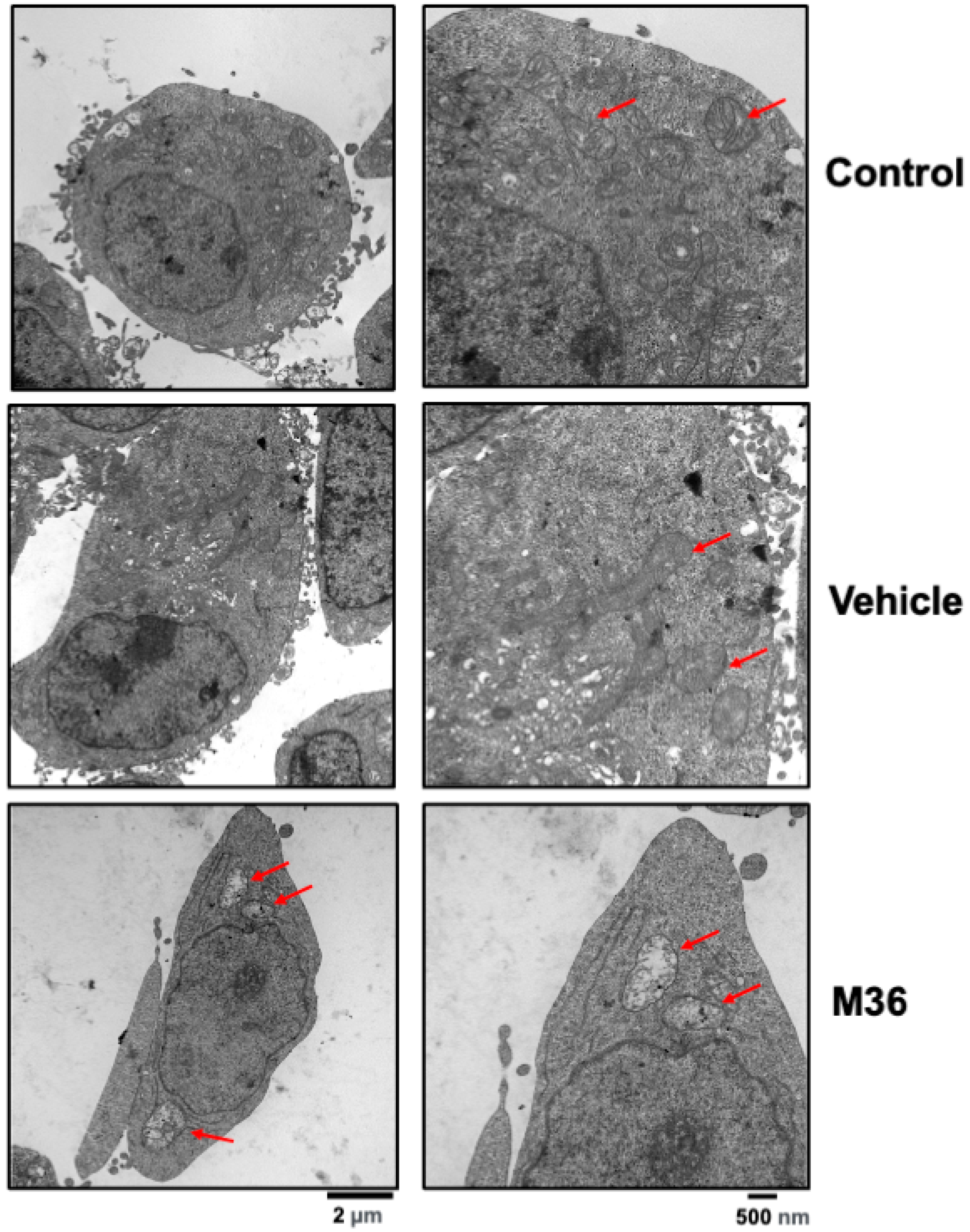 Ijms 25 02712 g006 Ijms 25 02712 g006