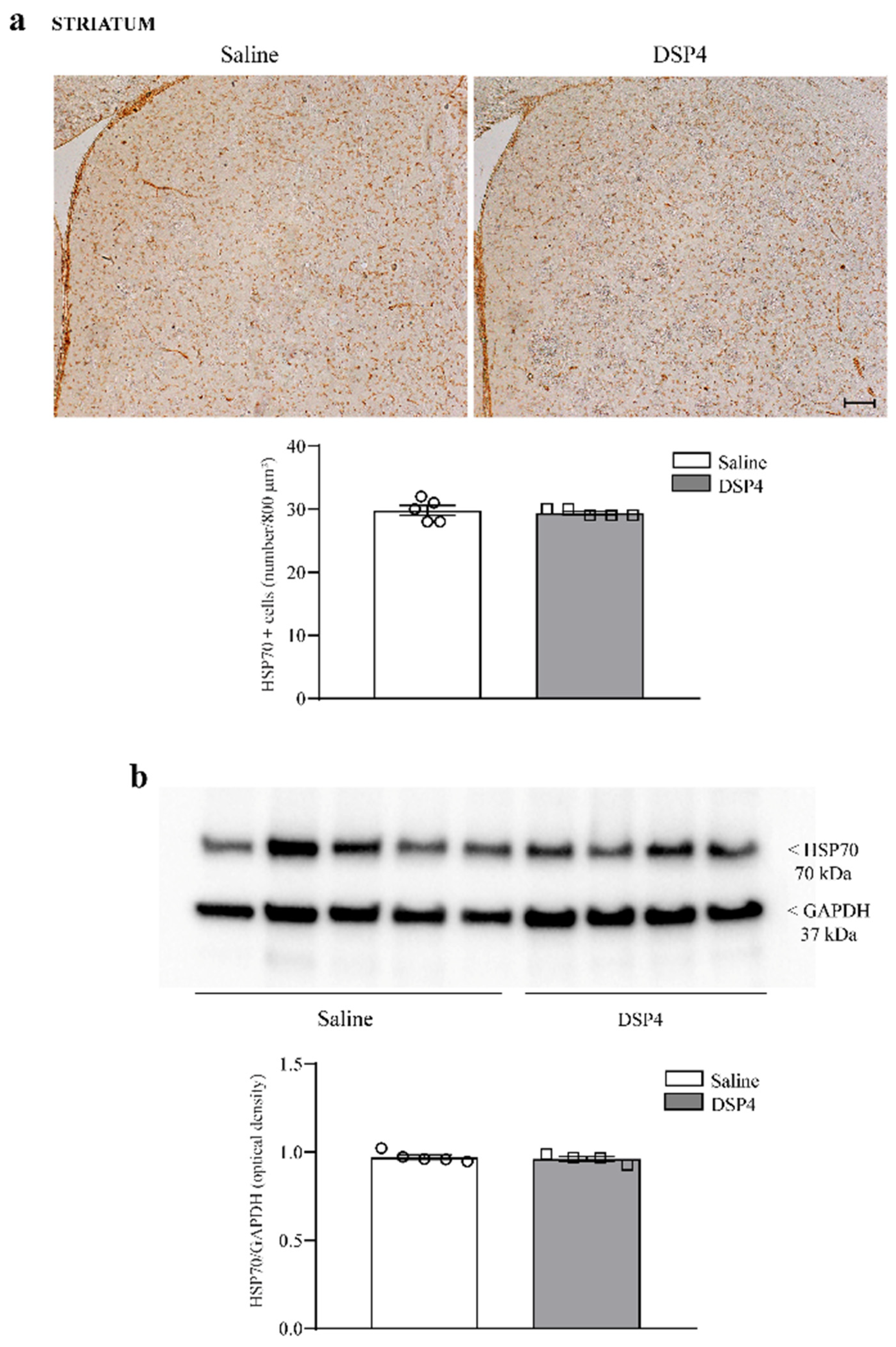 Ijms 25 03159 g005 Ijms 25 03159 g005
