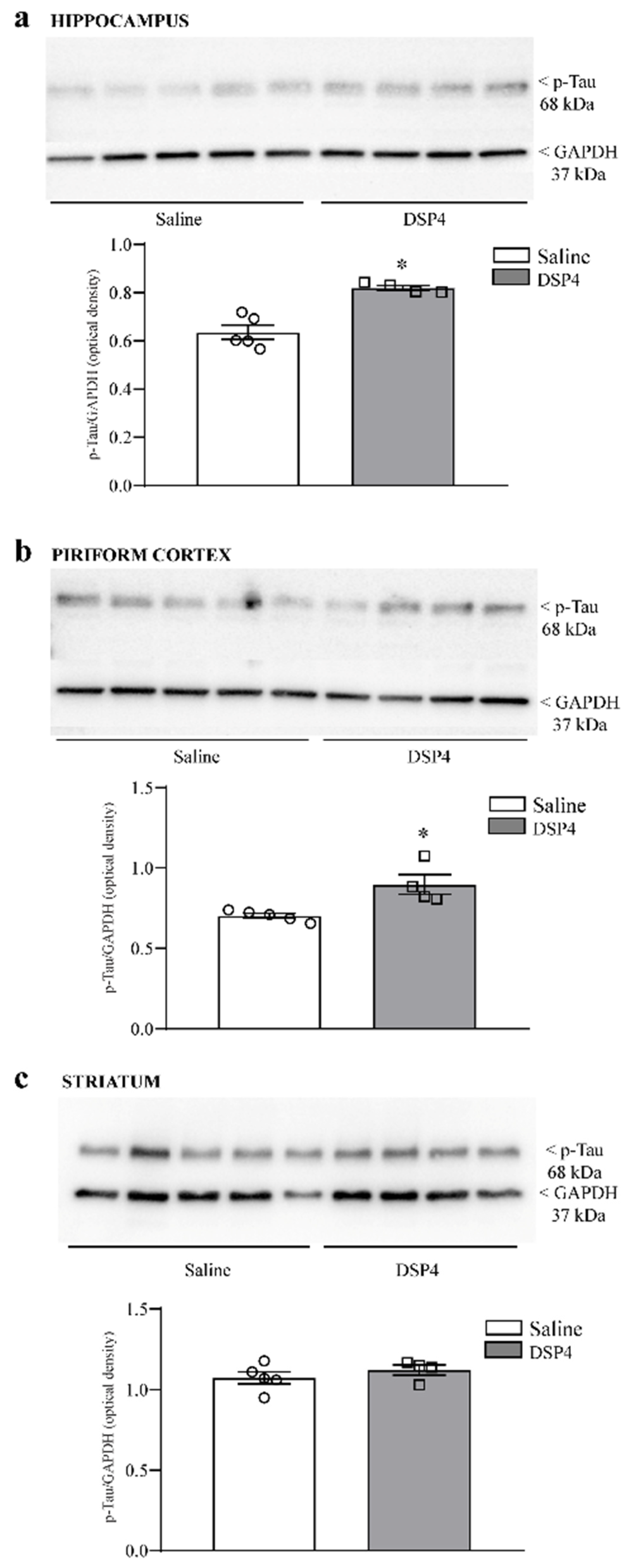 Ijms 25 03159 g009 Ijms 25 03159 g009