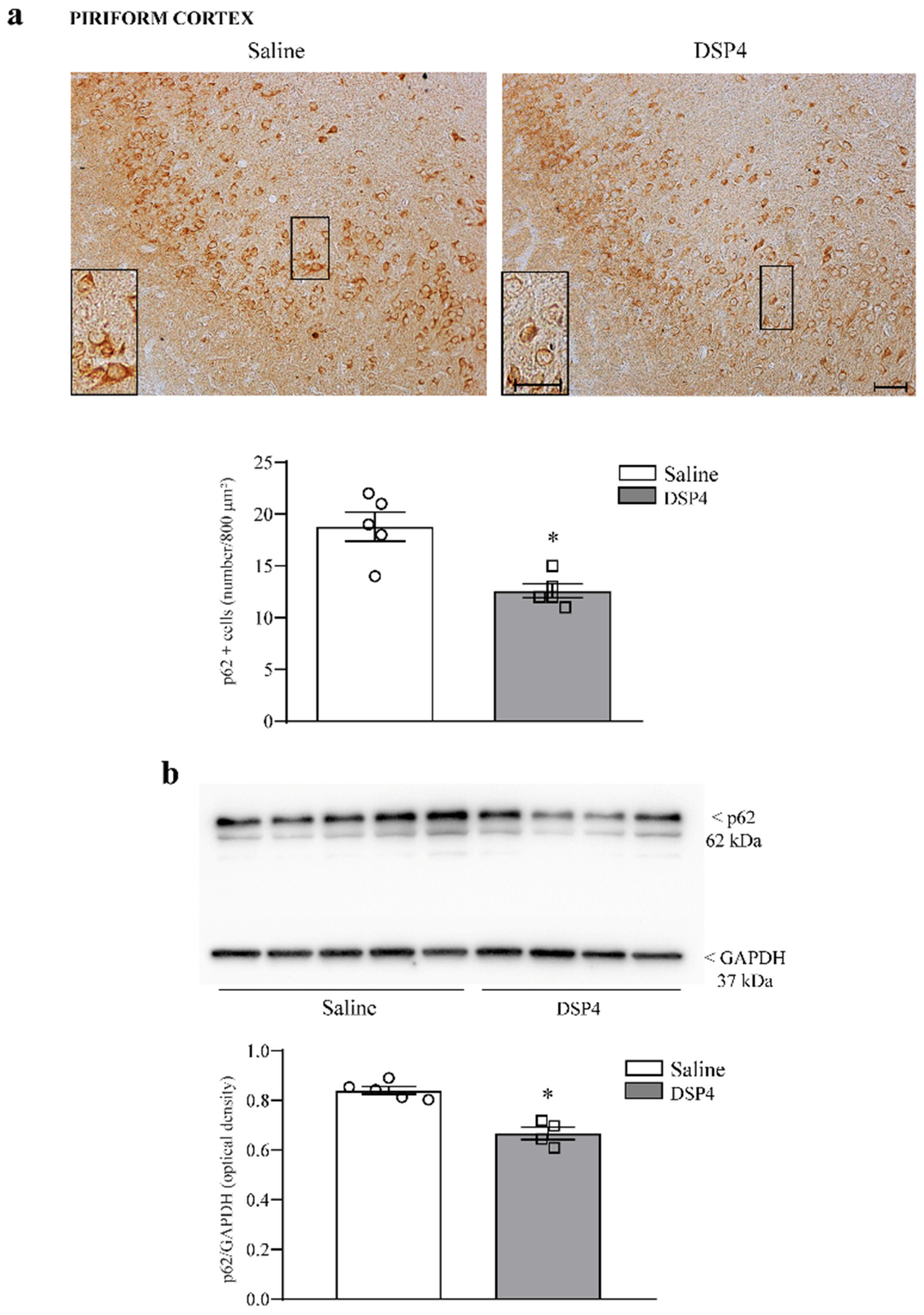 Ijms 25 03159 g011 Ijms 25 03159 g011