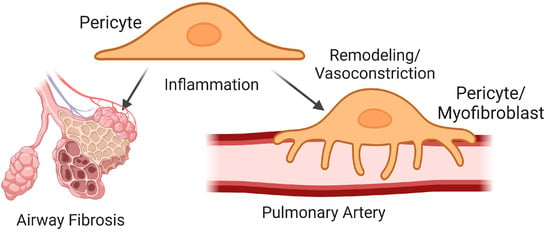 IJMS | Free Full-Text | Role of Sensory Nerves in Pulmonary Fibrosis