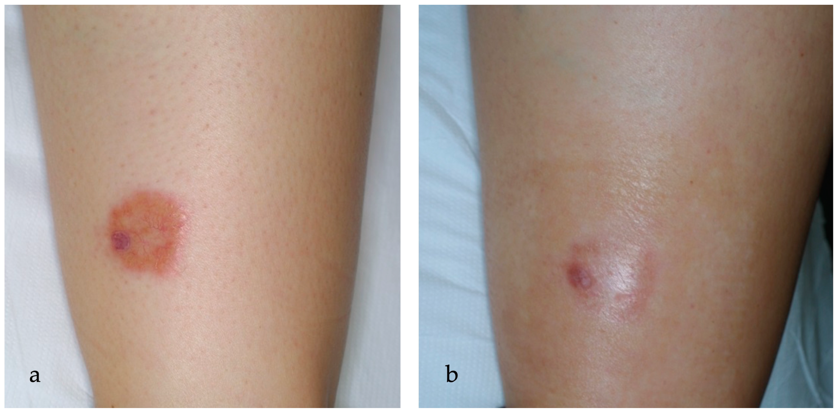 Ijms 25 03608 g004 Ijms 25 03608 g004