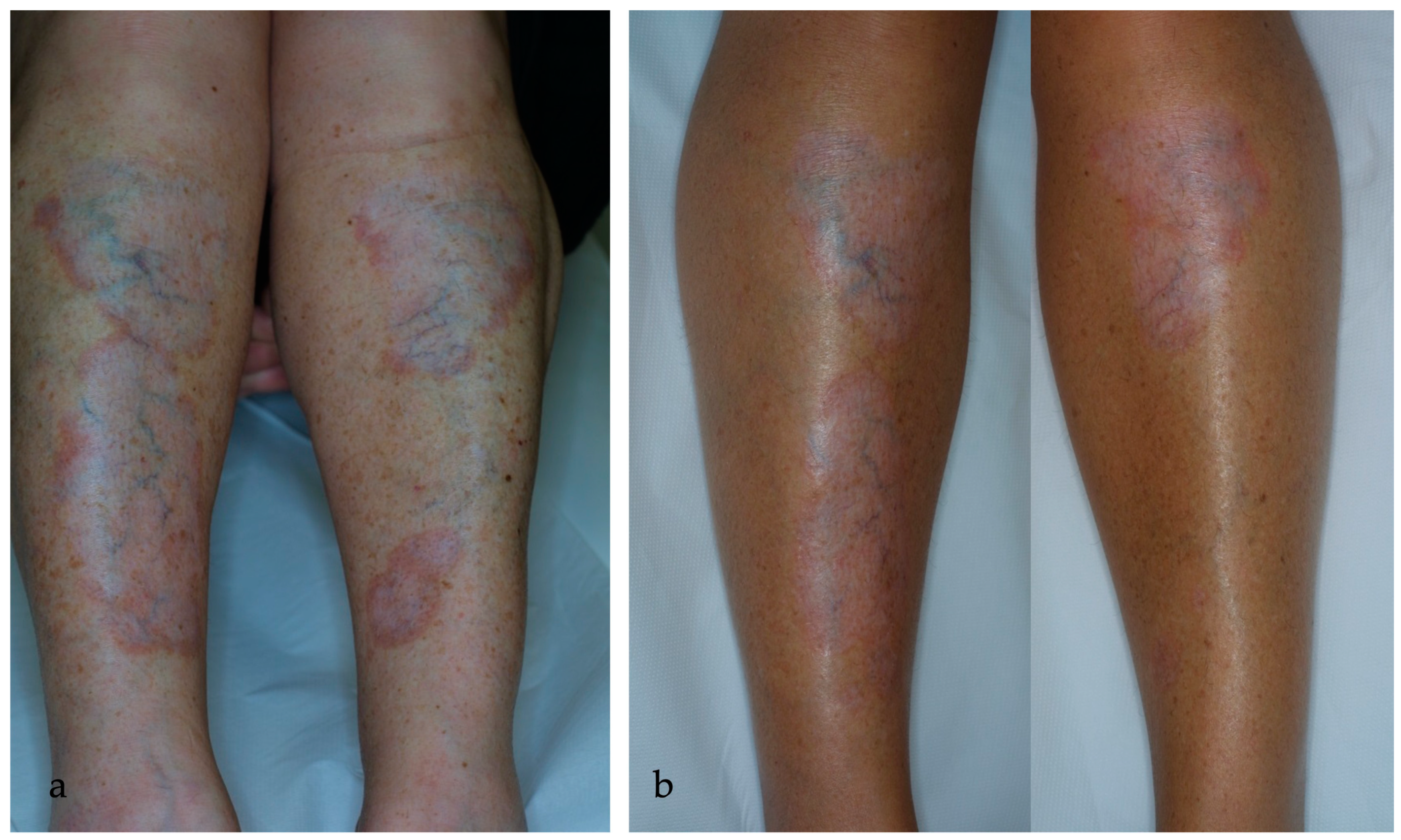 Ijms 25 03608 g005 Ijms 25 03608 g005