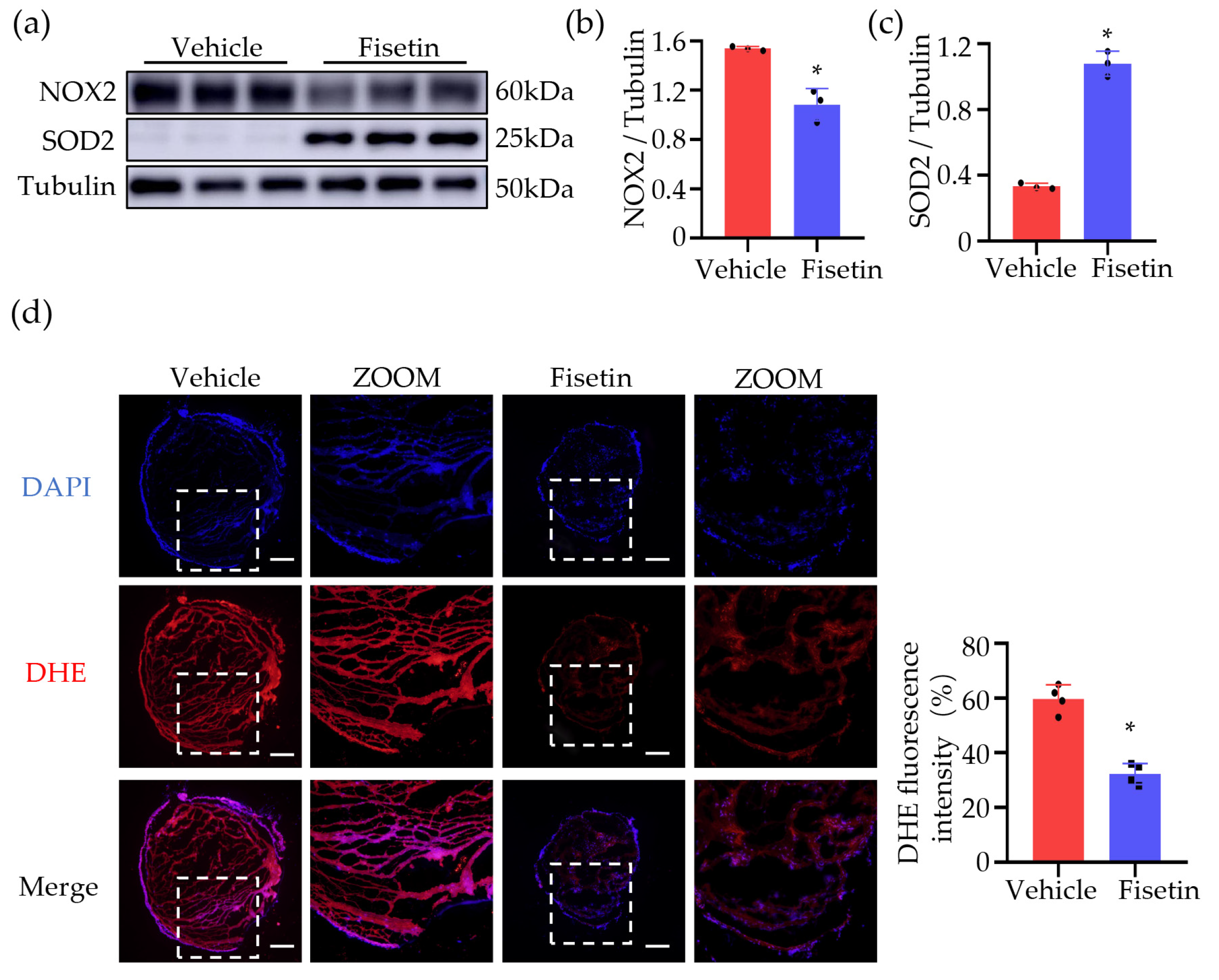 Ijms Free Full Text Fisetin Alleviates Inflammation And Oxidative