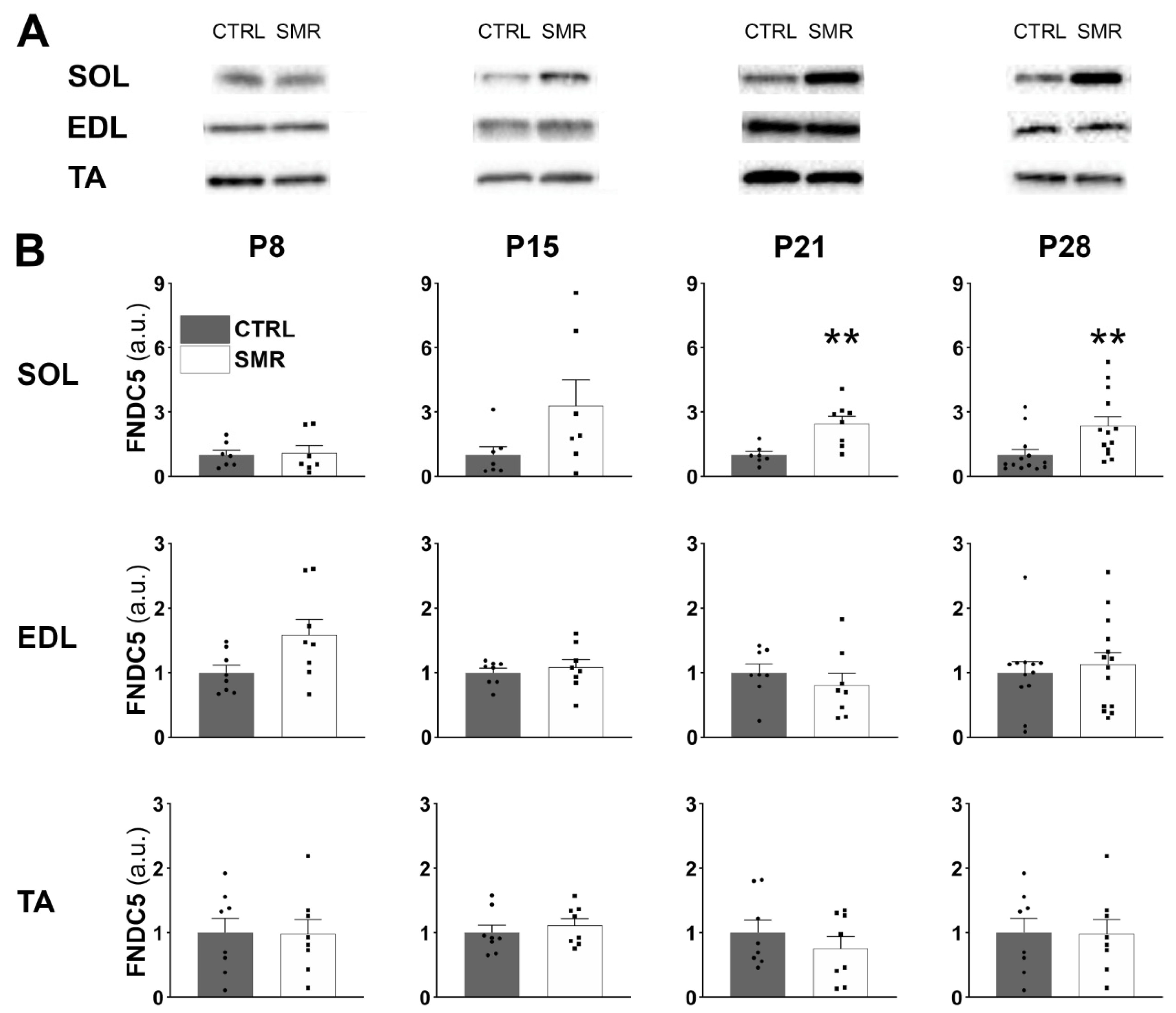 IJMS | Free Full-Text | Early Movement Restriction Affects FNDC5/Irisin ...