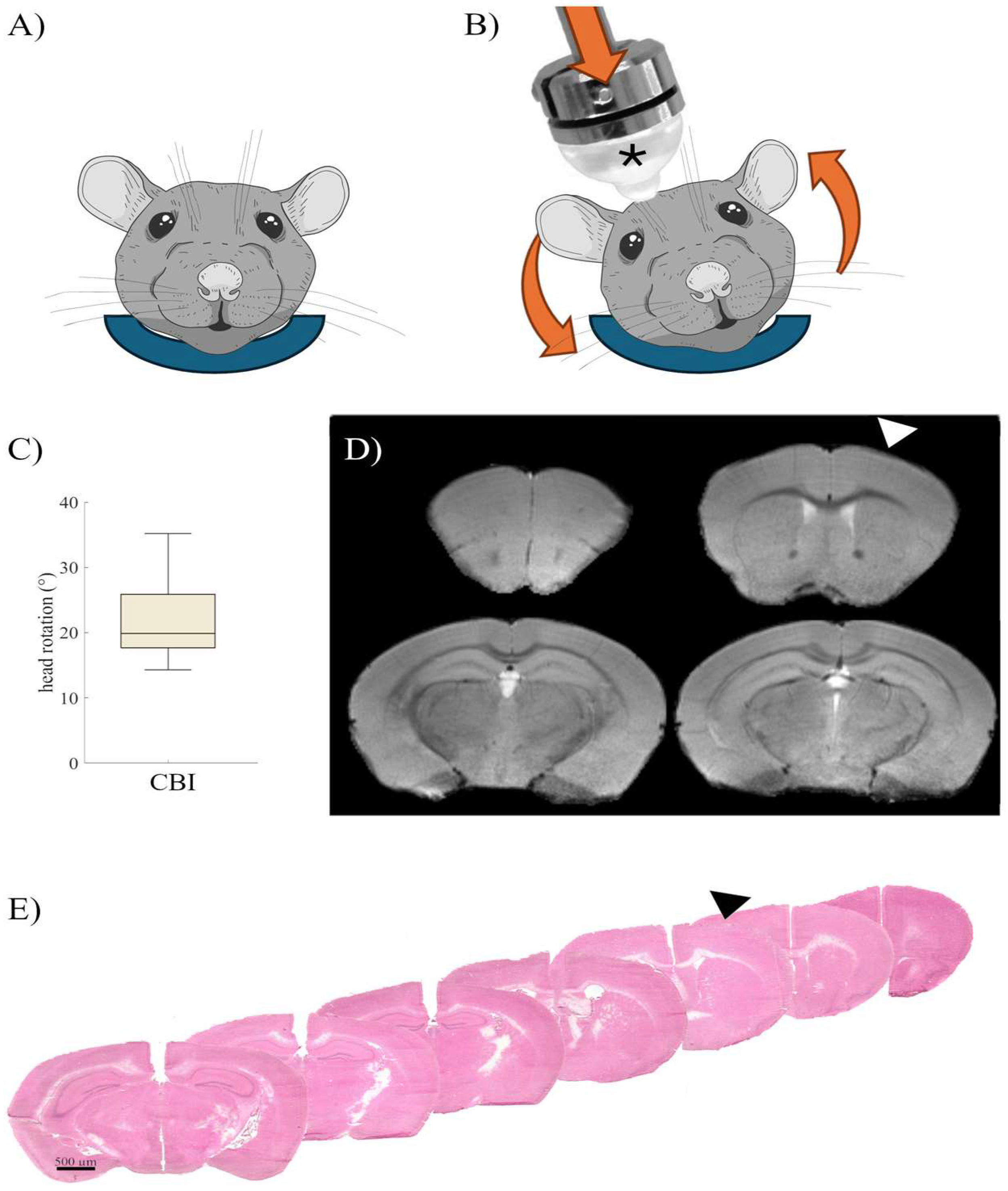 IJMS | Free Full-Text | Early Blood–Brain Barrier