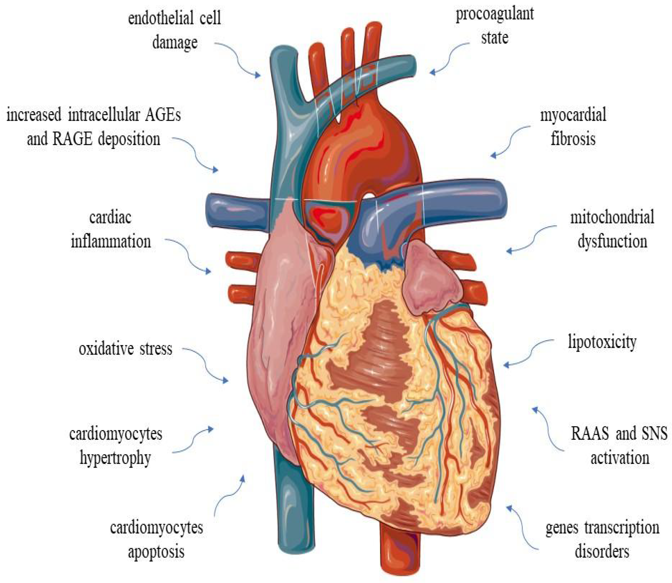 Pathophysiology and Advances in the Therapy of Cardiomyopathy in ...