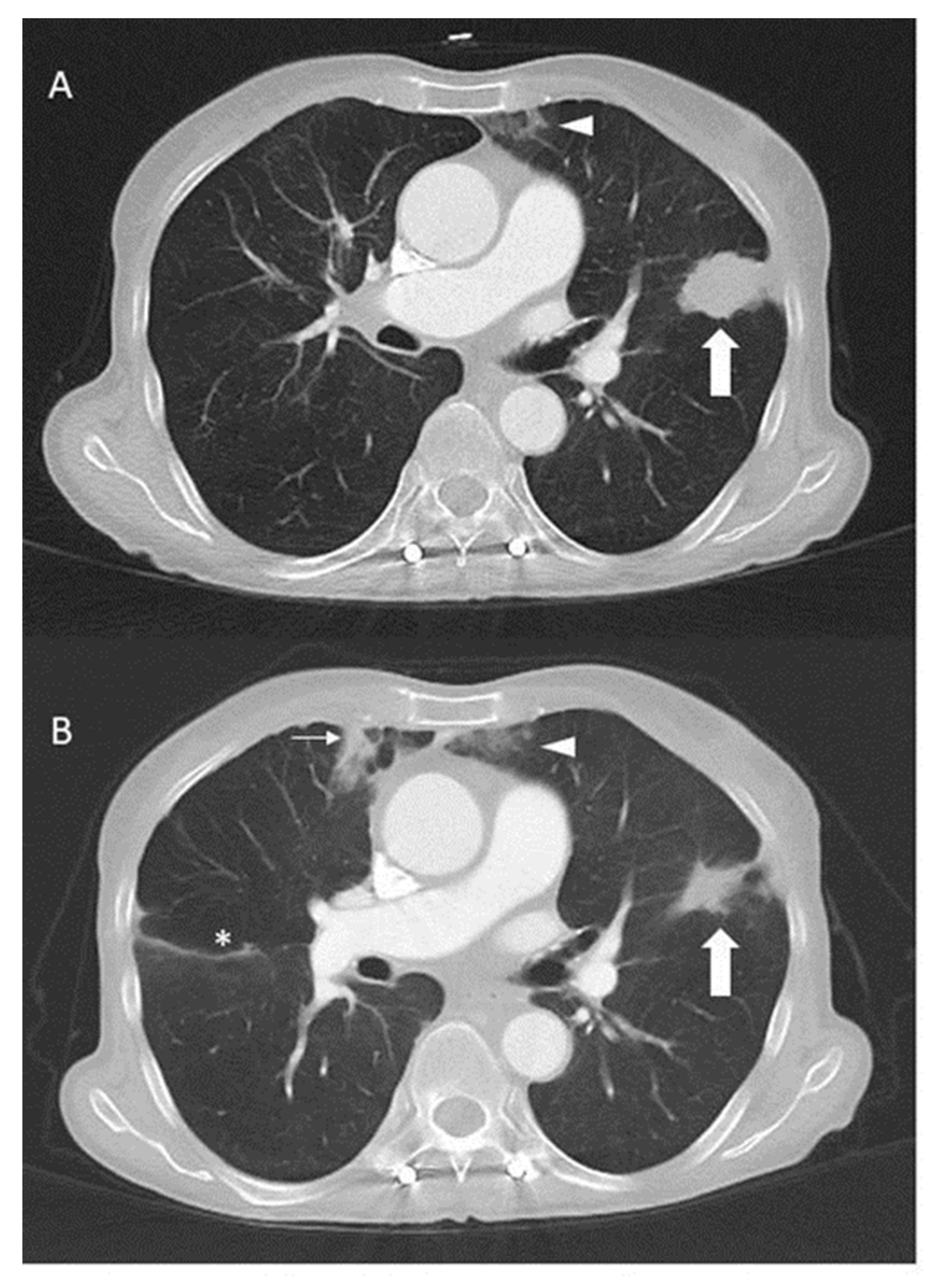 Ijms 25 05698 g002 Ijms 25 05698 g002