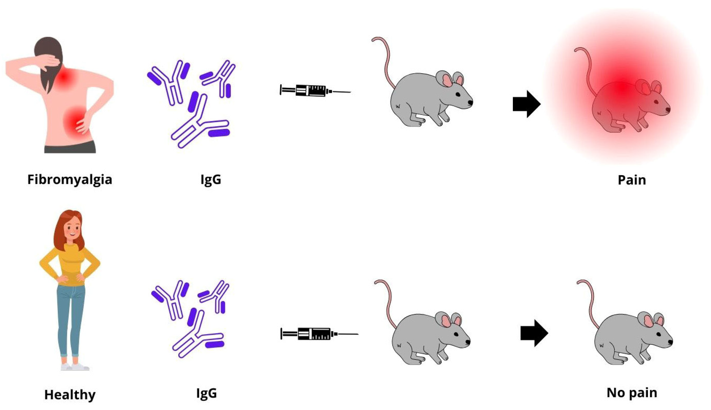 IJMS | Free Full-Text | Inflammation, Autoimmunity, and Infection in  Fibromyalgia: A Narrative Review