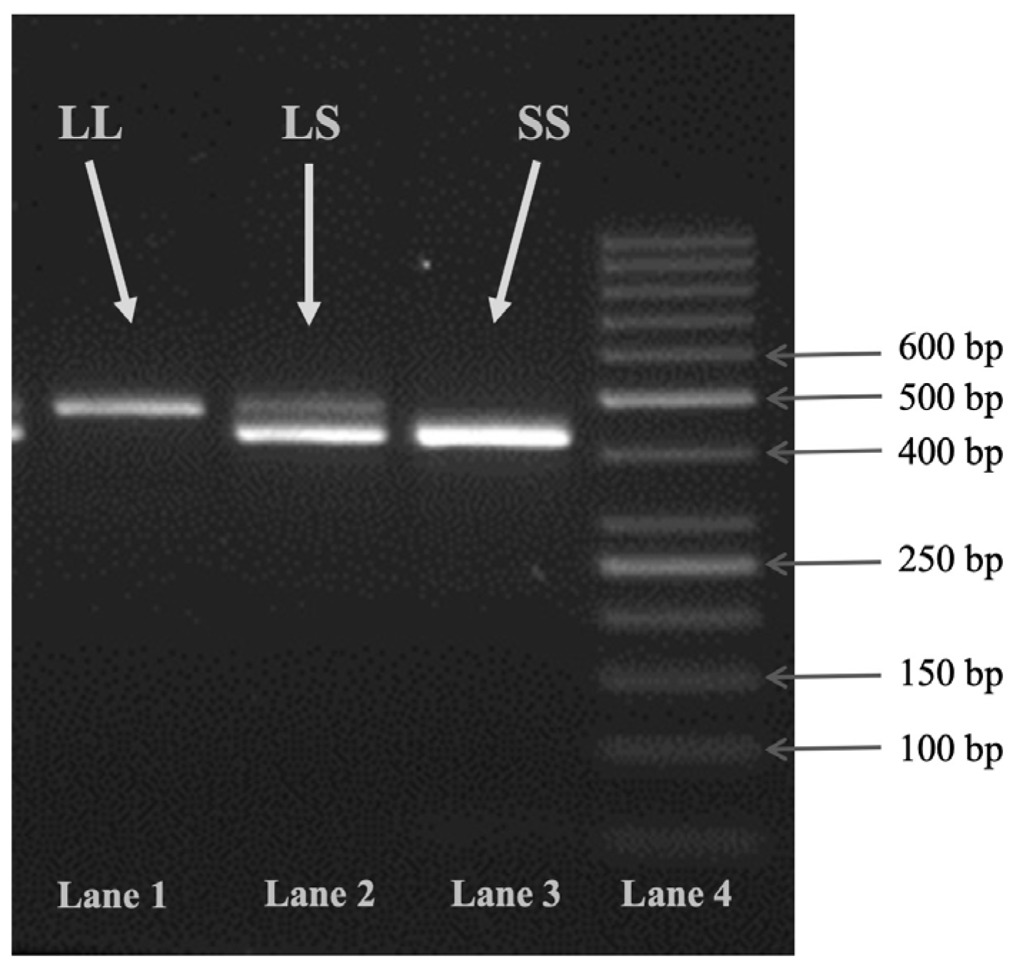 IJMS | Free Full-Text | DNA Sequence Variations Affecting Serotonin ...